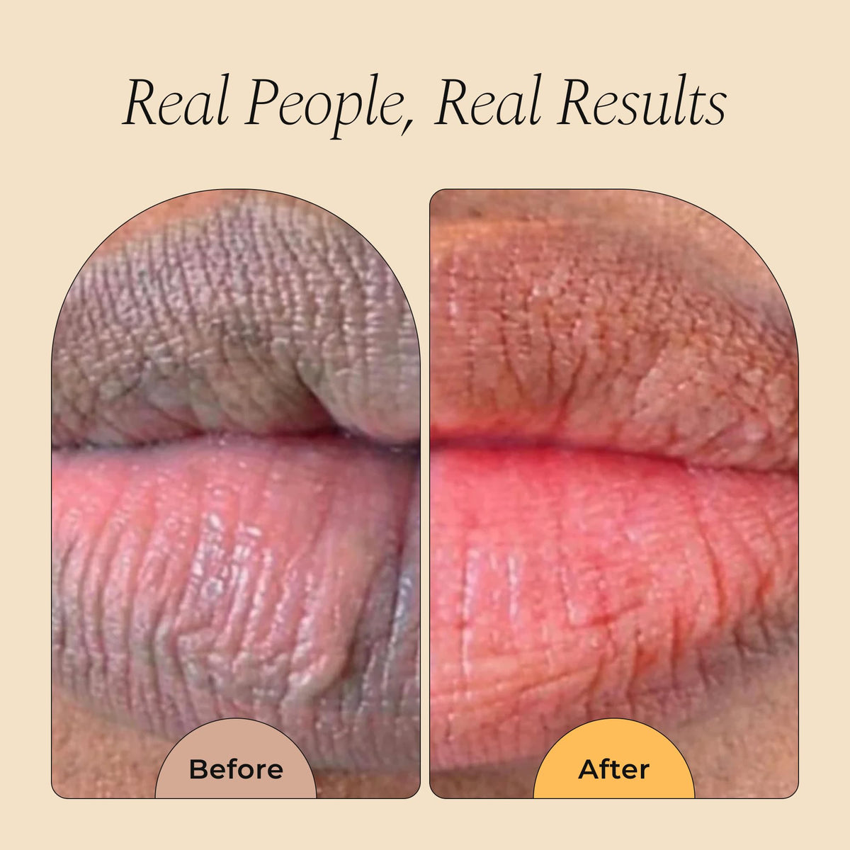 Glo Melanin All Natural Lemon and Turmeric Lip Balm - Natural Lip Balm Illuminate Your Smile - FENGGESTORE20