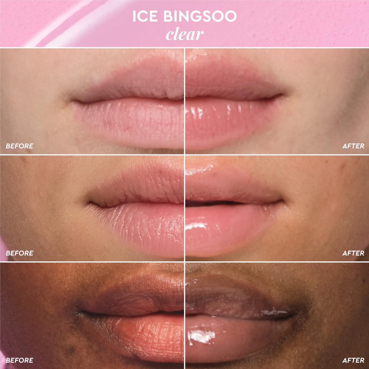 Glow Recipe Glass Balm Lip Treatment - 12Hr Hydrating Lip Balm & Moisturizer with Hyaluronic Acid to Smooth, Plump & Protect from Dryness, High Shine Finish - Clear Tint, Ice Bingsoo (15 ml) - FENGGESTORE20