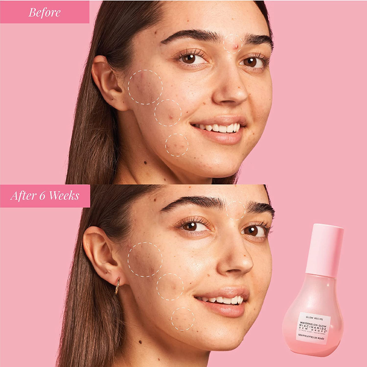 Glow Recipe Watermelon Niacinamide Dew Drops, Korean Niacinamide Serum Drops, Hydrating Face Serum + Primer & Liquid Highlighter, - FENGGESTORE20