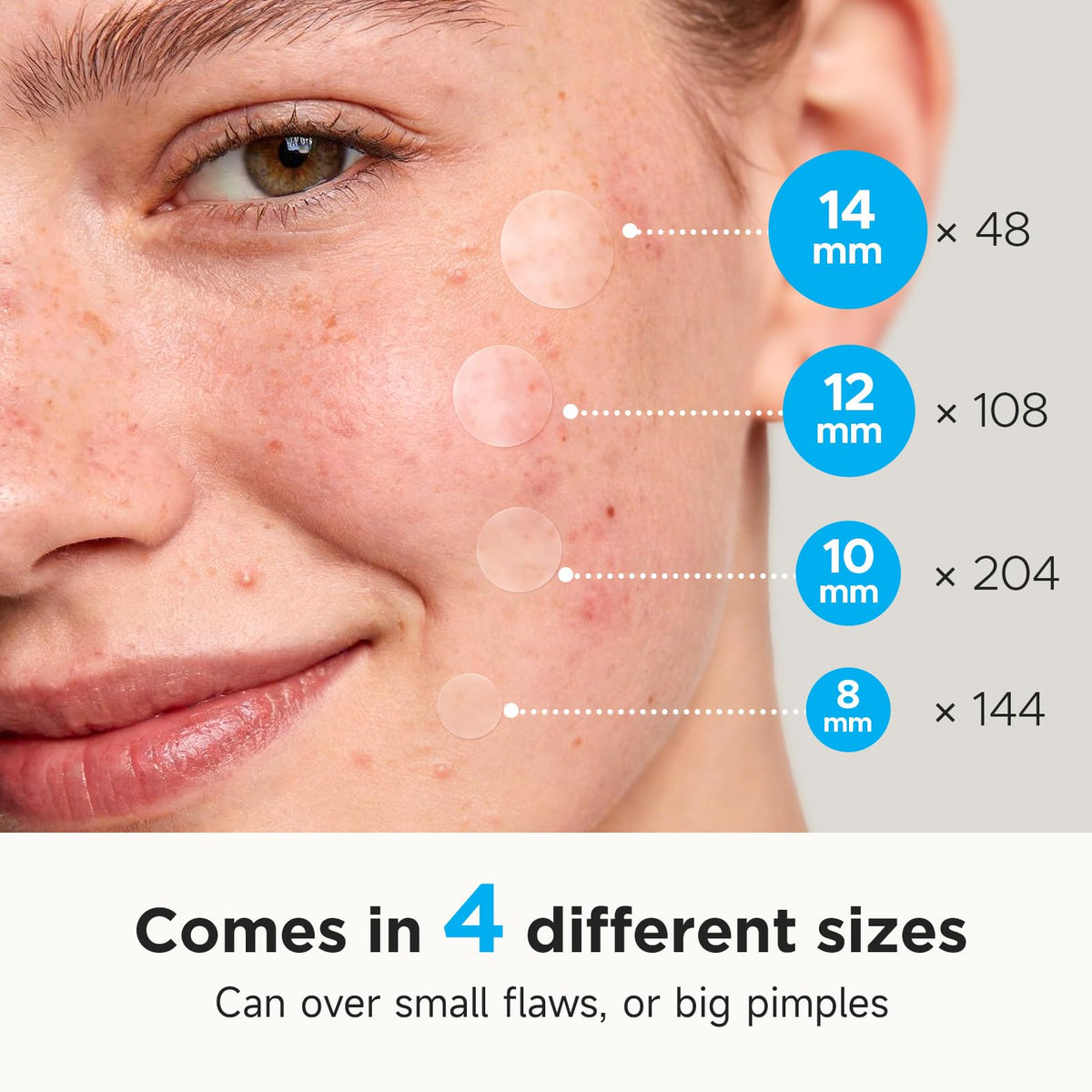 Glowpatch Pimple Patches for Face (504 Count), FSA Eligible Acne Patch Bulk, Zit Stickers 4 Sizes, Hydrocolloid Spot Stickers - FENGGESTORE20