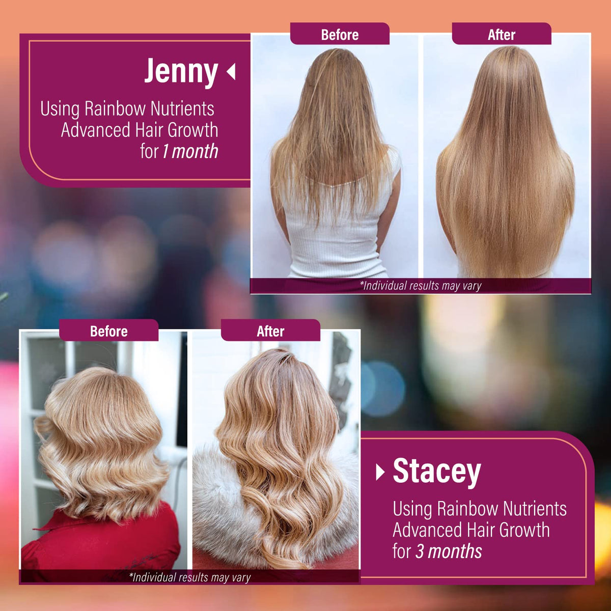 Hair Growth Vitamins for Women | Biotin 10,000mcg, Collagen, Patented OptiMSM®, goMCT - FENGGESTORE20
