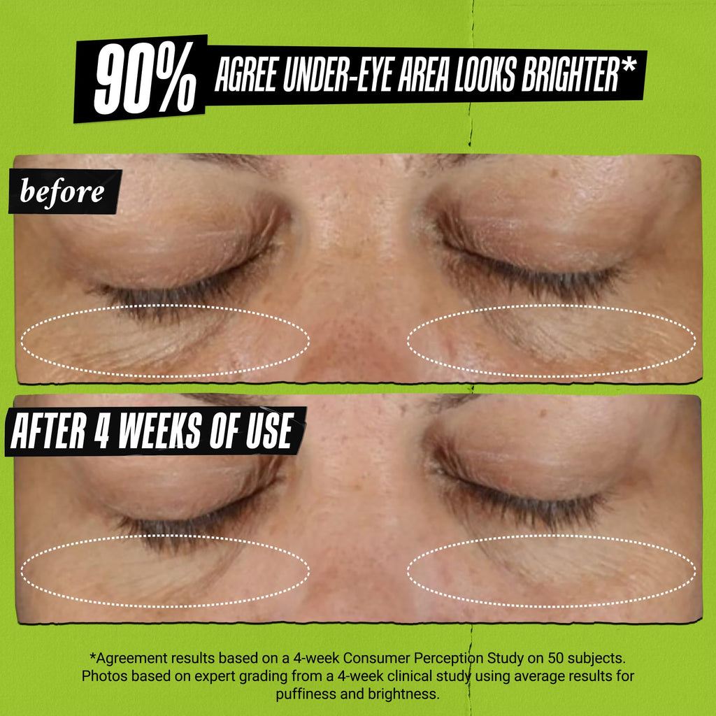 Kiehl's Avocado Eye Treatment, Nourishing and Hydrating Eye Cream, Avocado Oil and Caffeine to Energize and Invigorate Skin, Tired Eyes - FENGGESTORE20