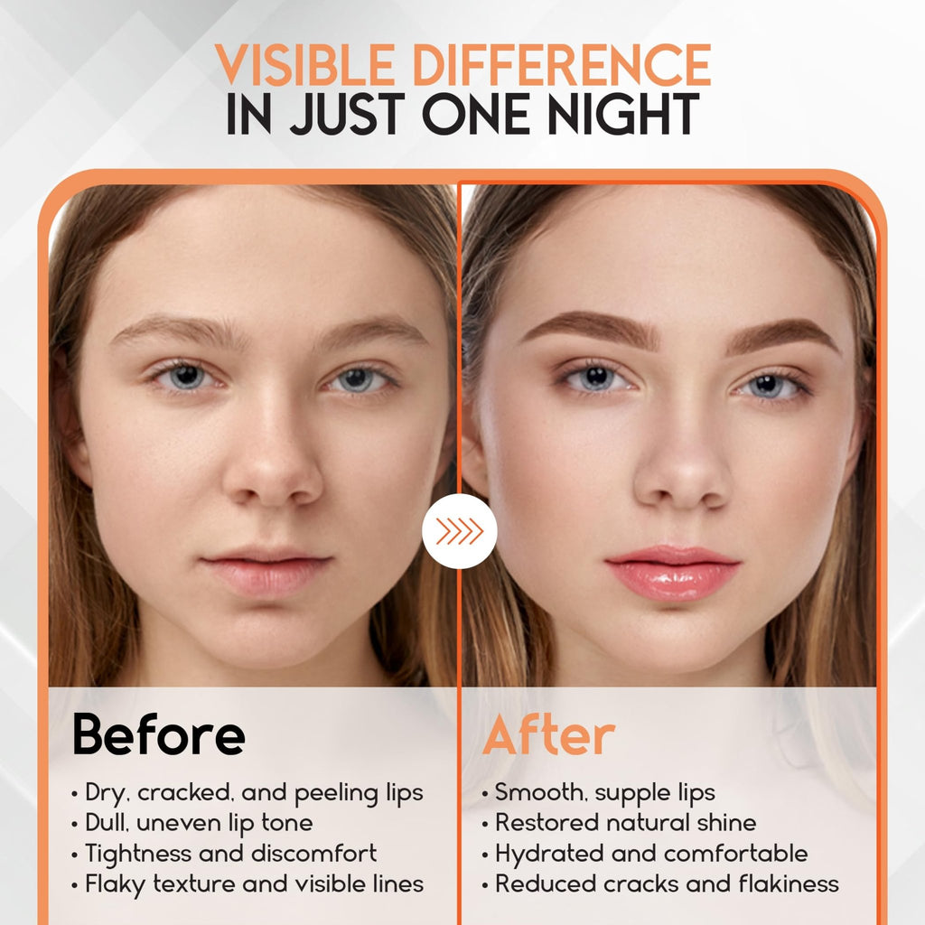 Lip Mask Overnight with Hyaluronic Acid & Collagen, Lip Sleeping Mask for Dry Cracked Lips - FENGGESTORE20