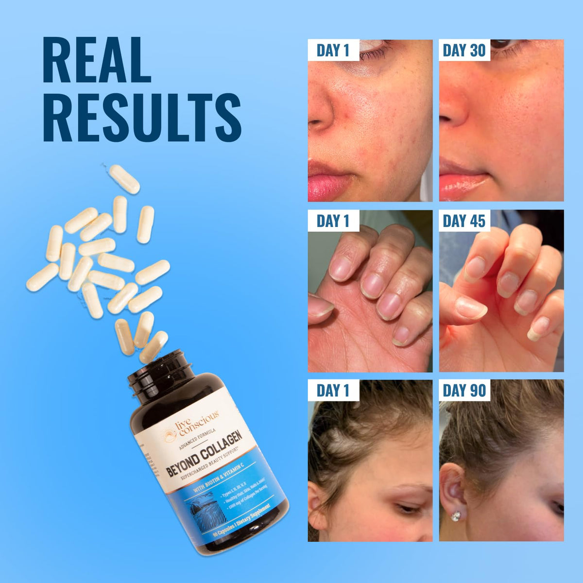 Live Conscious Beyond Collagen Multi Collagen Capsules - Types I, II, III, V & X - Hydrolyzed Blend with Biotin & Vitamin C - FENGGESTORE20