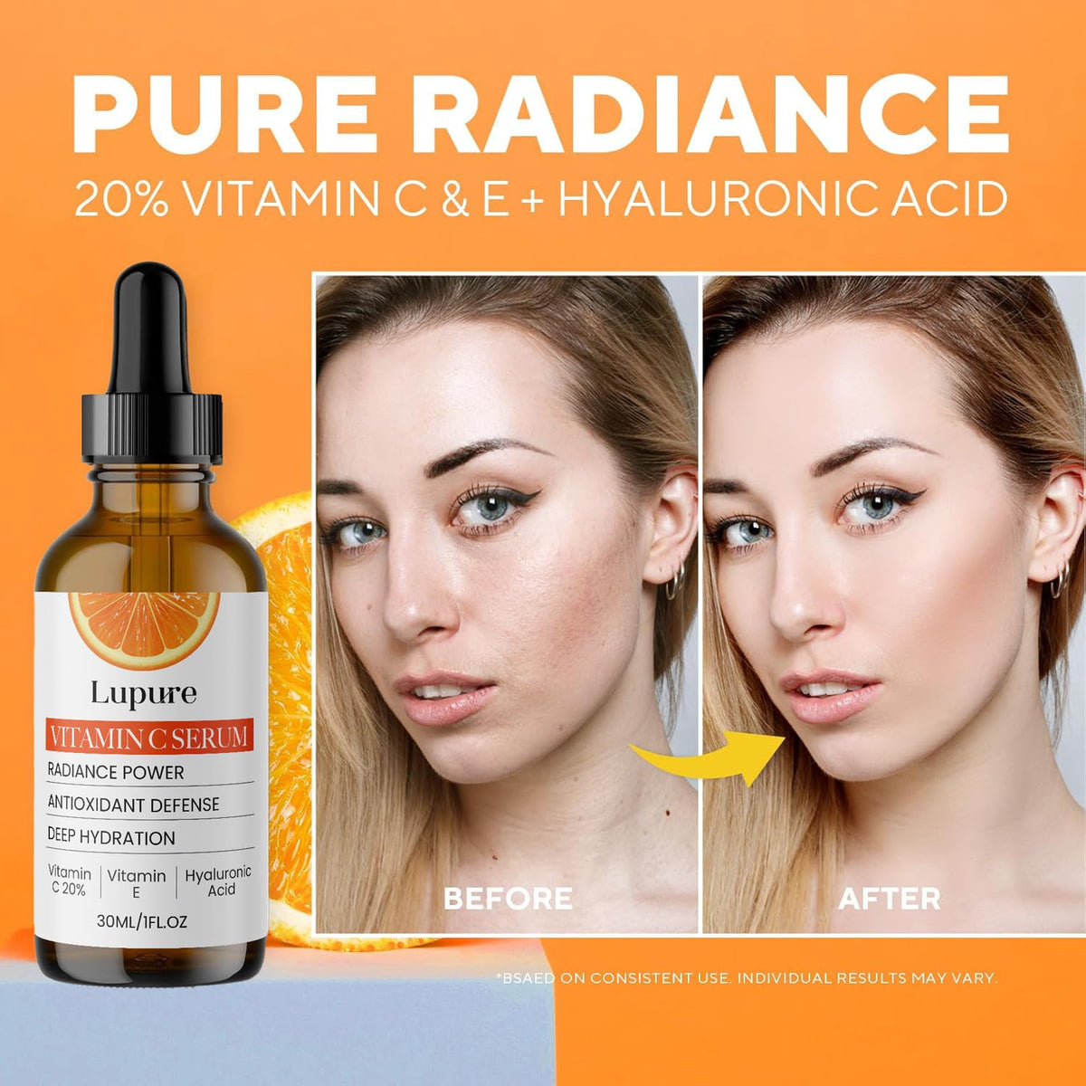 Lupure Professional Vitamin C Face Serum 20%, Anti Aging Facial Super Vit C Serum with Ascorbic Acid Hyaluronic Acid & Vitamin E for Dark Spots, - FENGGESTORE20