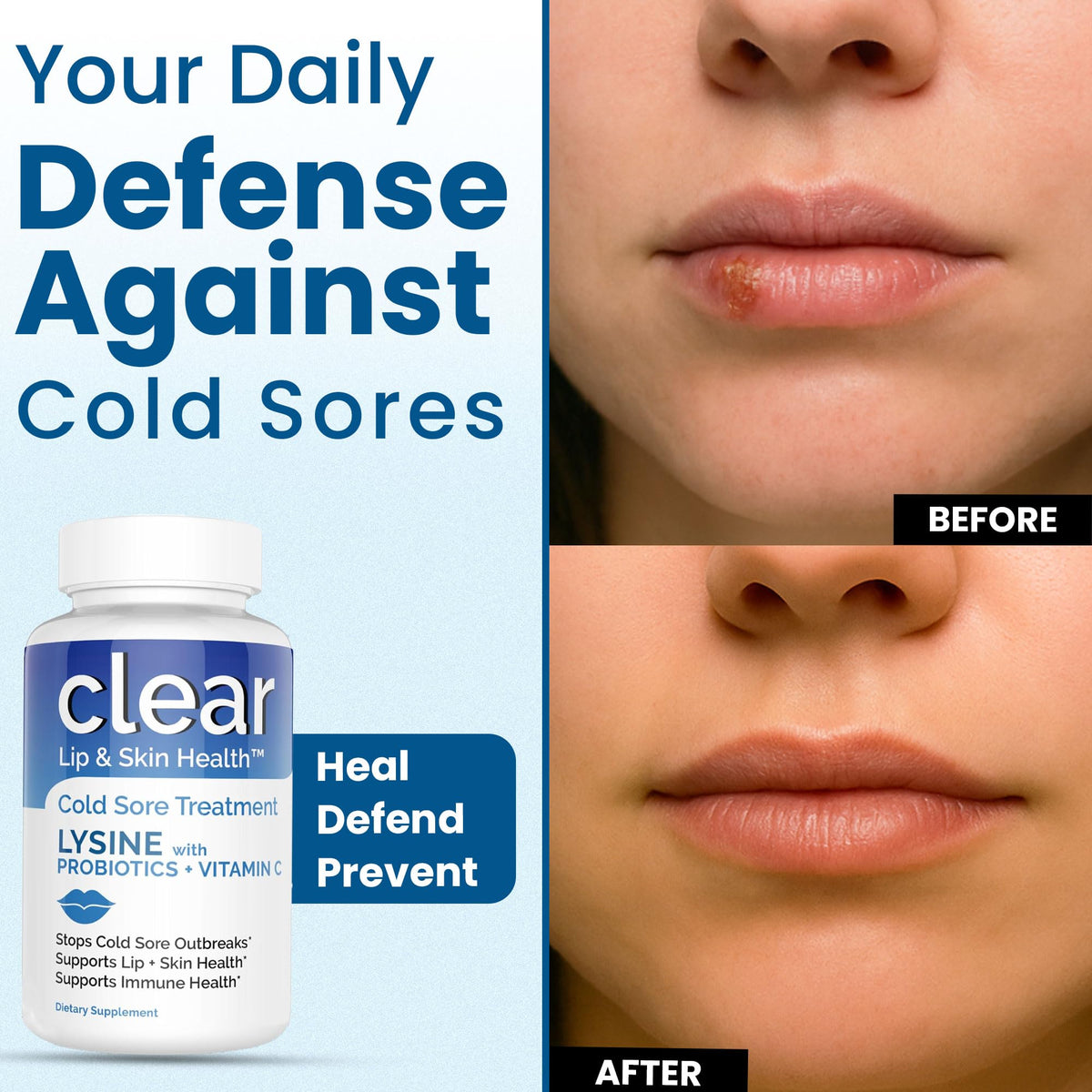 Lysine Cold Sore Treatment for Lips with Pre-Probiotics & VIT C | 1 Month Supply | Supercharged Lysine Capsules with Rhamnosus & Acidophilus for Cold Sores Relief - FENGGESTORE20