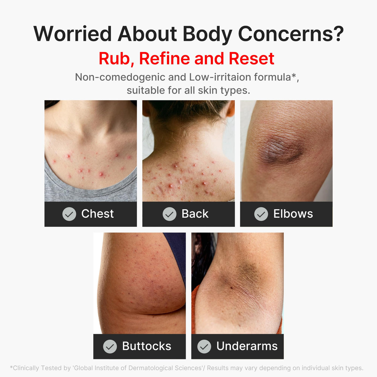medicube Body Peel Shot with Kojic Acid and Turmeric | Gentle Body Brightening & Exfoliating Serum with BHA, LHA & PHA for Dead Skin Cells - FENGGESTORE20