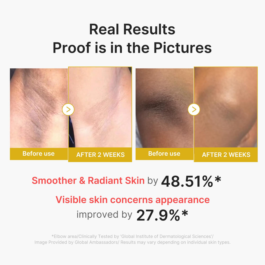 medicube Body Peel Shot with Kojic Acid and Turmeric | Gentle Body Brightening & Exfoliating Serum with BHA, LHA & PHA for Dead Skin Cells - FENGGESTORE20