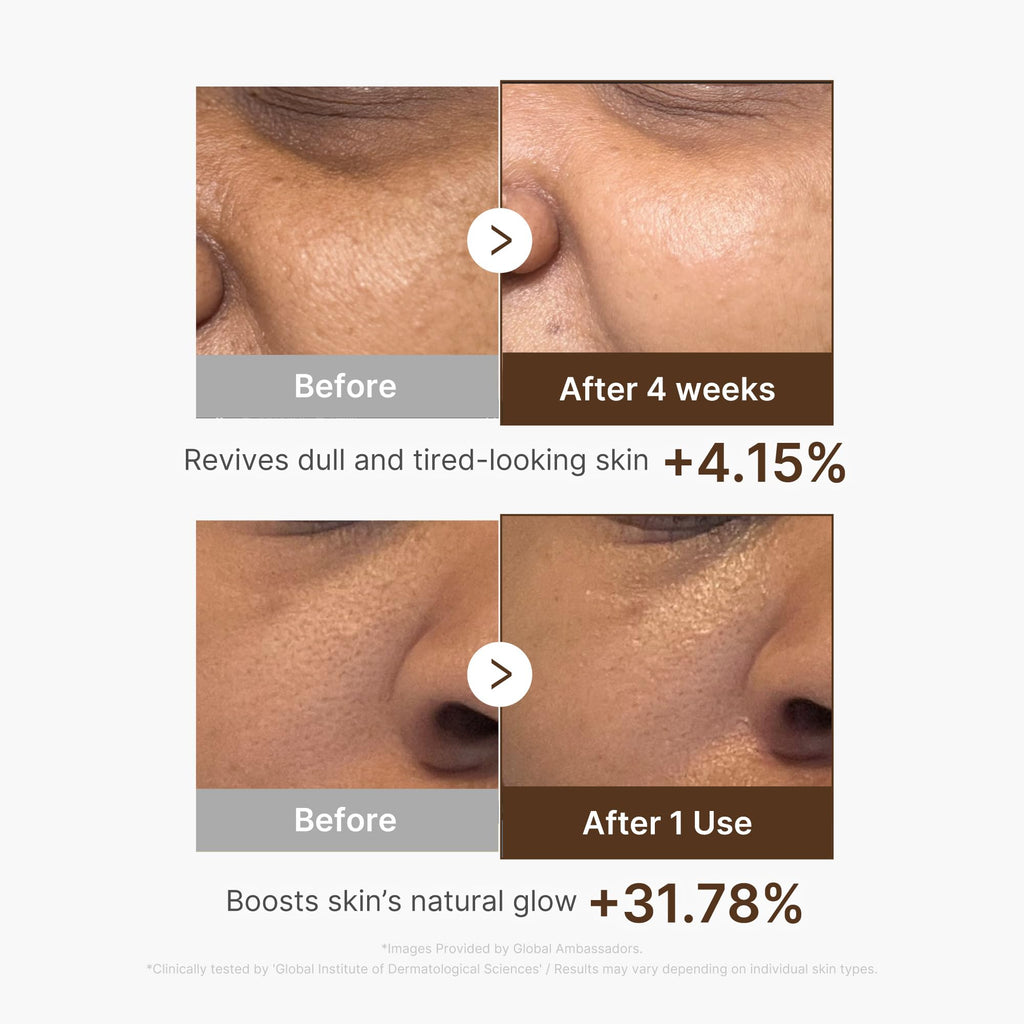 medicube Deep Vitamin C Capsule Serum | Hydrating Vitamin C Serum for Dull & Uneven-Looking Skin with Visible Concerns - FENGGESTORE20