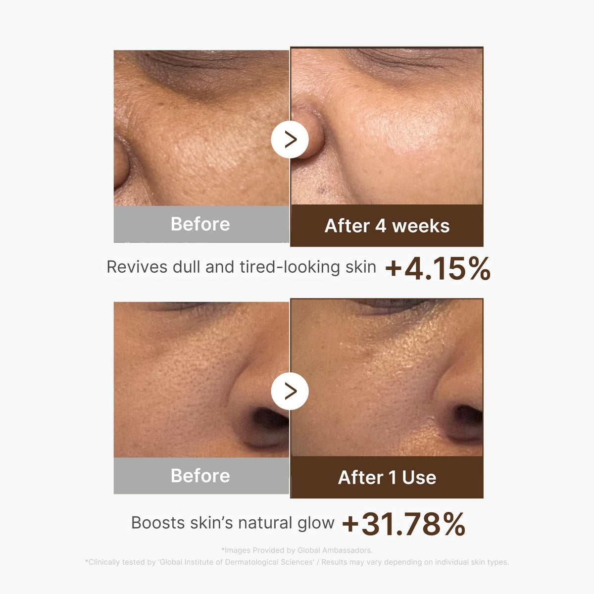 medicube Deep Vitamin C Capsule Serum | Hydrating Vitamin C Serum for Dull & Uneven-Looking Skin with Visible Concerns - FENGGESTORE20