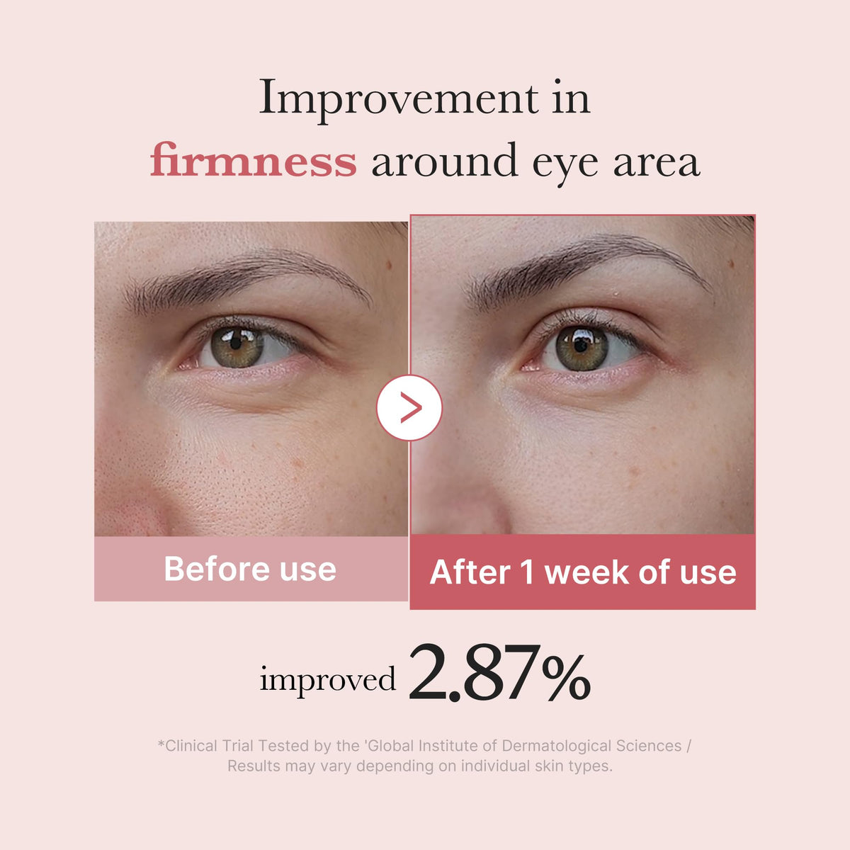 medicube Eye Serum with Salmon DNA PDRN & Pink Peptides | 99% Purity Retinol for Fine Lines - FENGGESTORE20