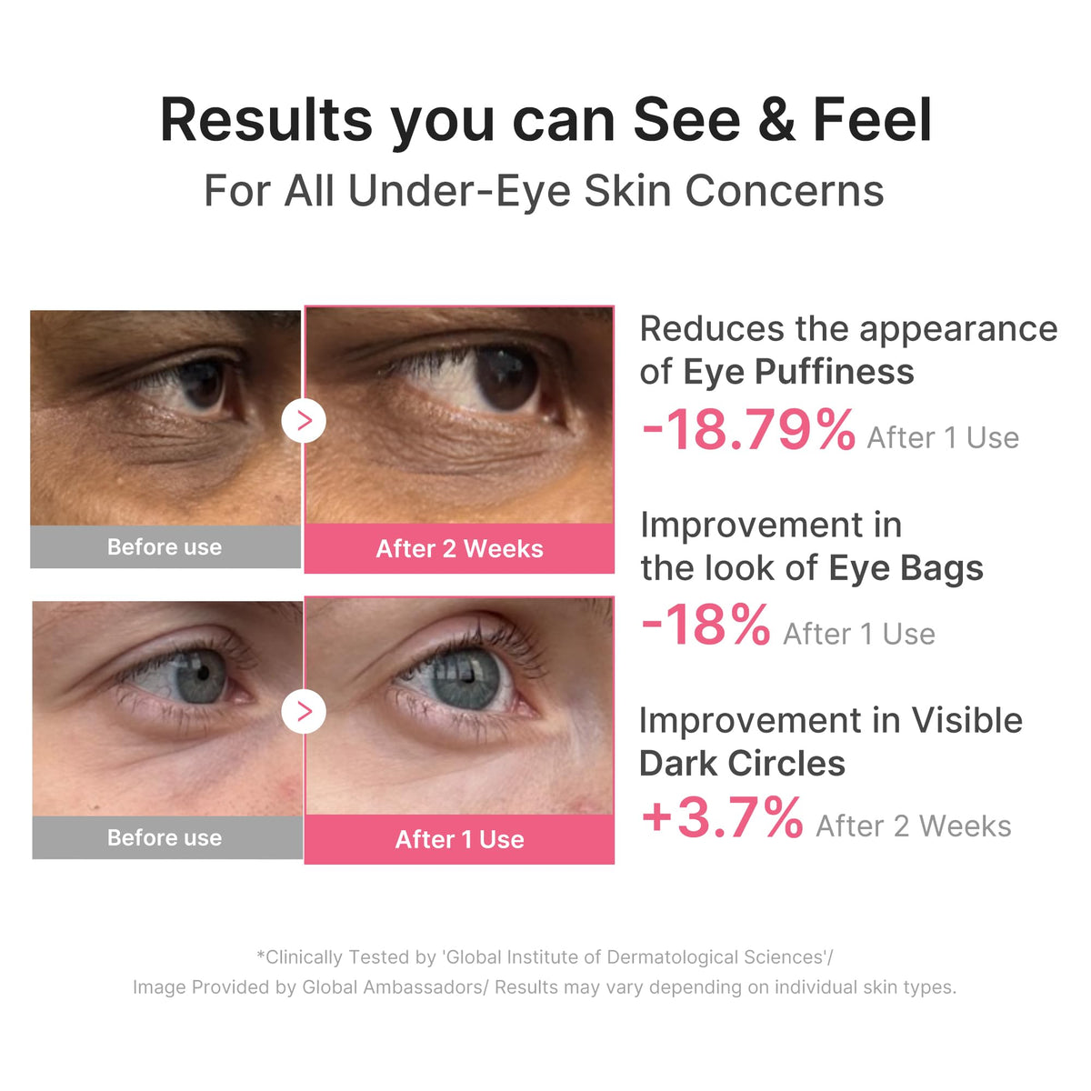 medicube PDRN Caffeine Collagen Eye Patch | Gel Eye Patches for the appearance of Dark Circles, Undereye Bags - FENGGESTORE20