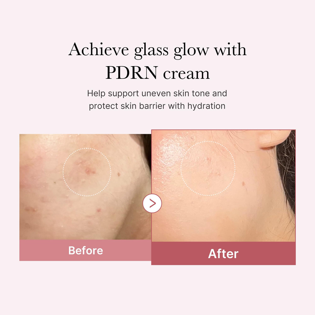 medicube PDRN Pink Hyaluronic Moisturizing Cream | Blemish Recovery, Relief & Hydrating Care | Restores Skin Elasticity & Glow - FENGGESTORE20