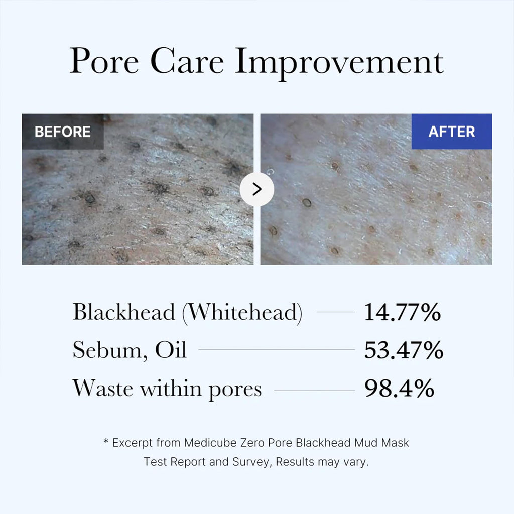 Medicube Zero Pore Blackhead Mud Facial Mask - Skin Cooling & Pore Tightening - 3 Minute Quick Dry Formula with AHA, BHA, PHA - FENGGESTORE20