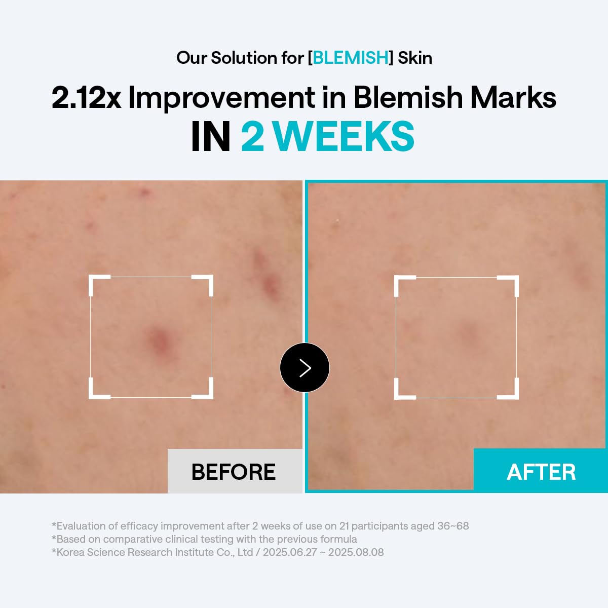 MEDIHEAL Toner Pads 100 Count - Madecassoside Blemish Care Toner Pad with Centella Asiatica - Improves Uneven Skin Tone & Deep Hydration - FENGGESTORE20