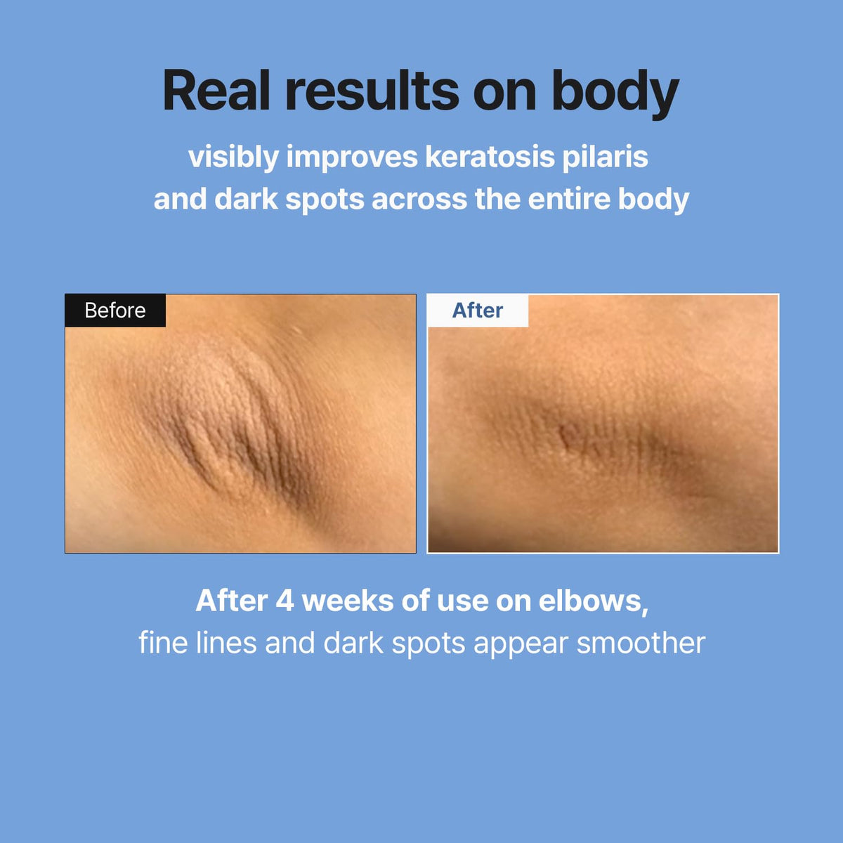 MEDITHERAPY Retinal Skin Booster Serum | Retinaldehyde, Niacinamide Anti-Aging Serum - K-Beauty Facial Serum for Fine Lines, Firming & Radiance - FENGGESTORE20