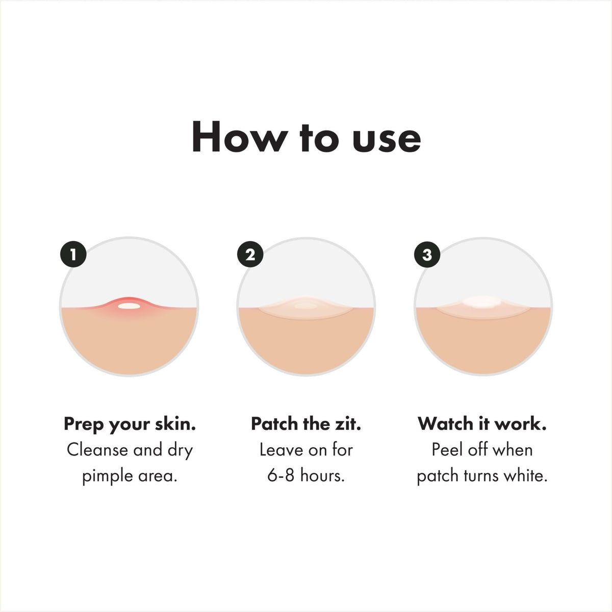 Mighty Patch™ Variety Pack from Hero Cosmetics - Hydrocolloid Acne Pimple Patches for Covering Zits and Blemishes - FENGGESTORE20