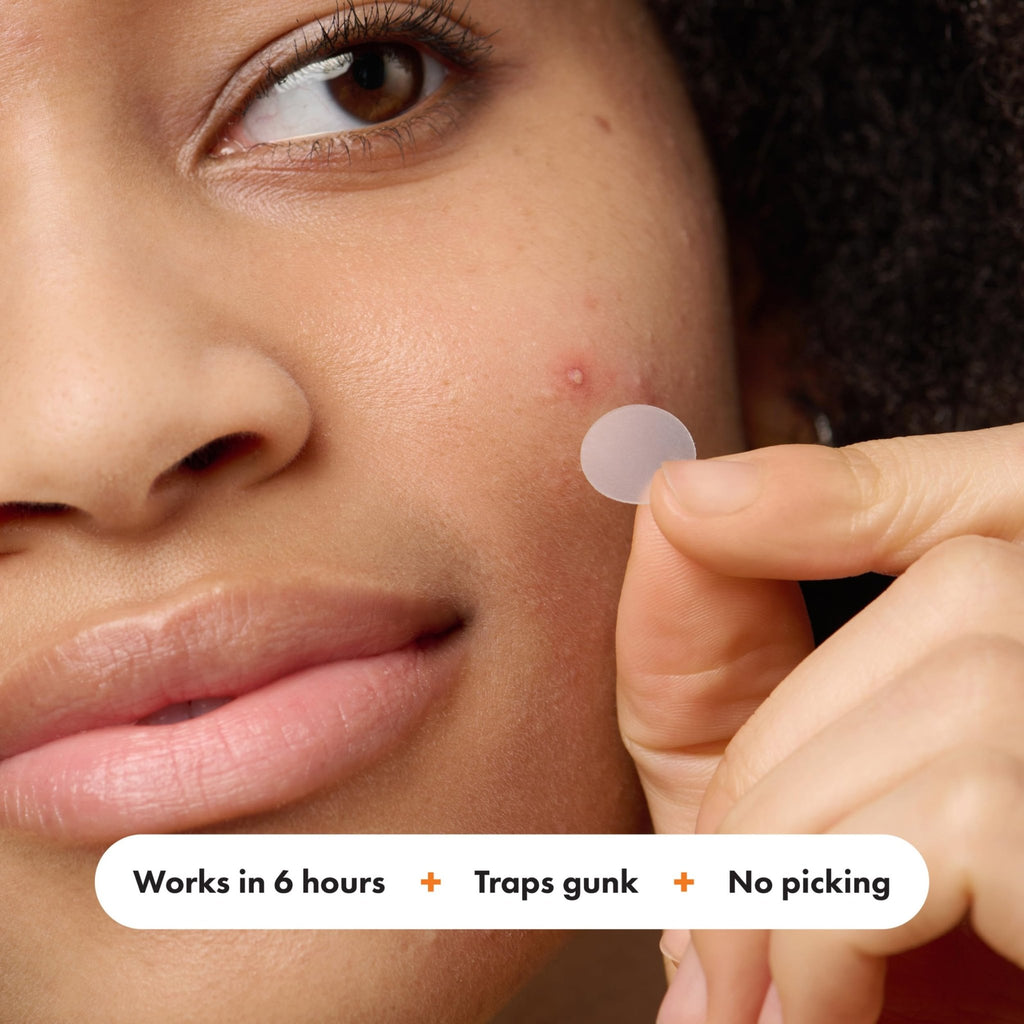 Mighty Patch™ Variety Pack from Hero Cosmetics - Hydrocolloid Acne Pimple Patches for Covering Zits and Blemishes - FENGGESTORE20