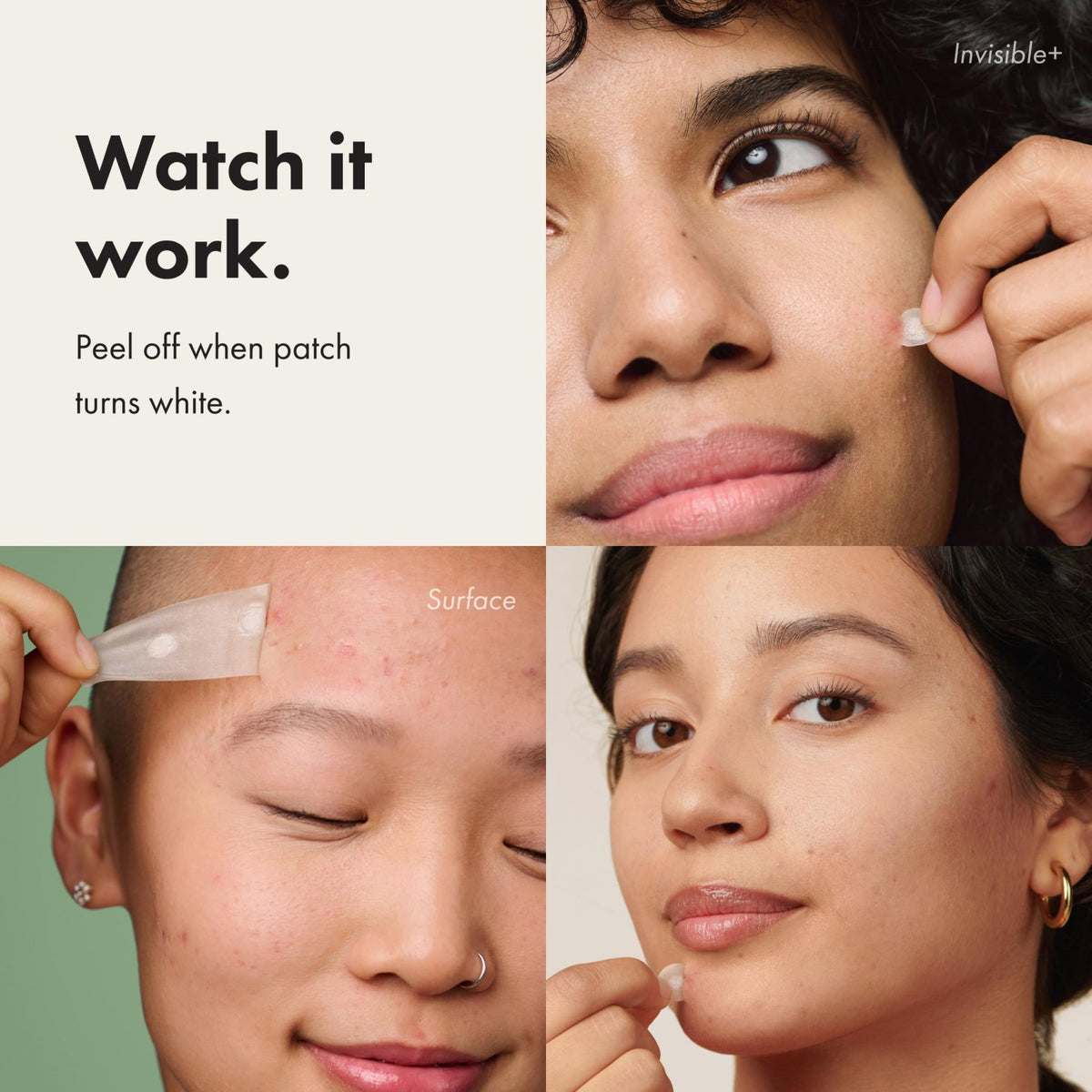 Mighty Patch™ Variety Pack from Hero Cosmetics - Hydrocolloid Acne Pimple Patches for Covering Zits and Blemishes - FENGGESTORE20
