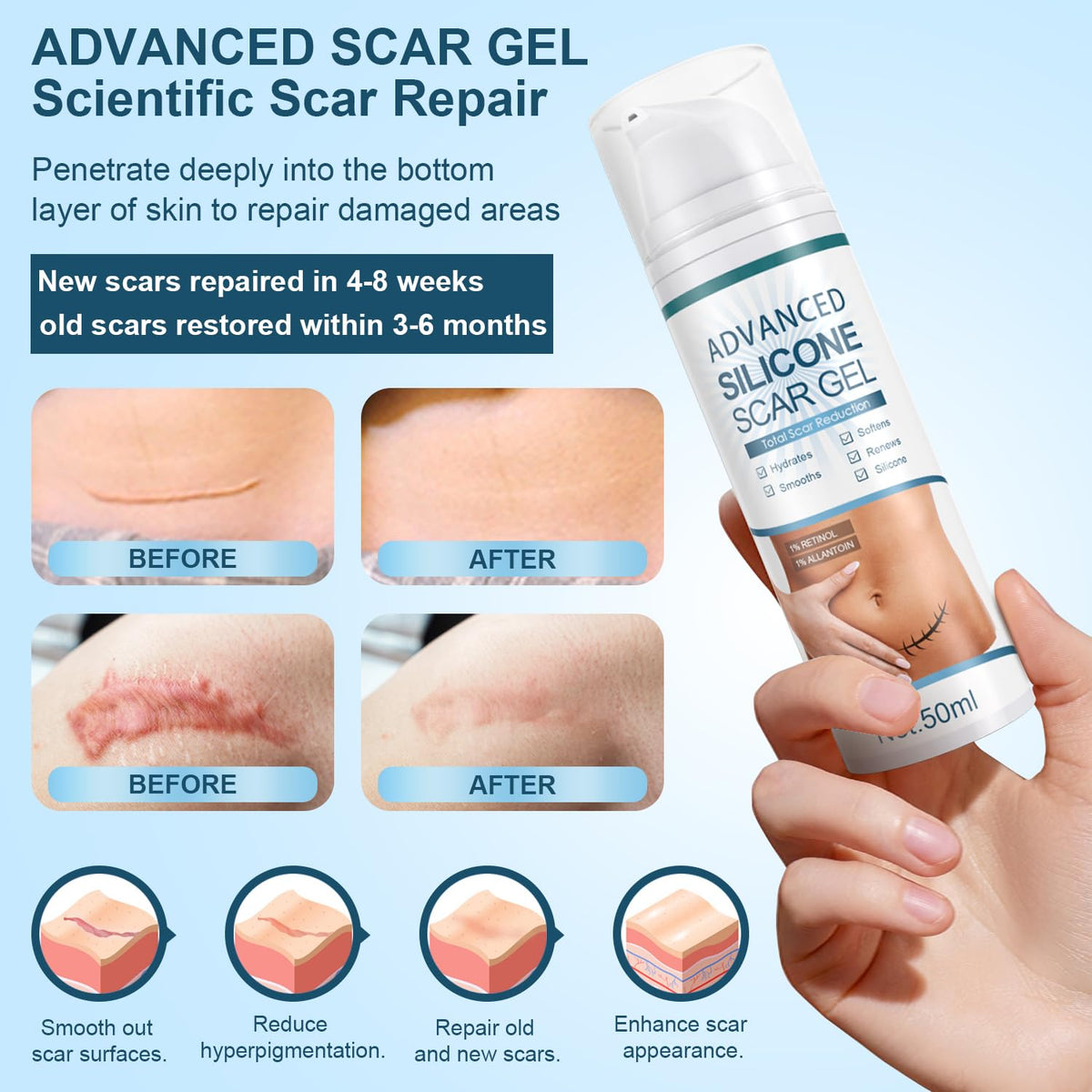 Mitgary Advanced Scar Gel, Silicone Scar Gel, Treats Old and New Scars, Reduces the Appearance of Scars from, Body, Face, Stretch Marks - FENGGESTORE20
