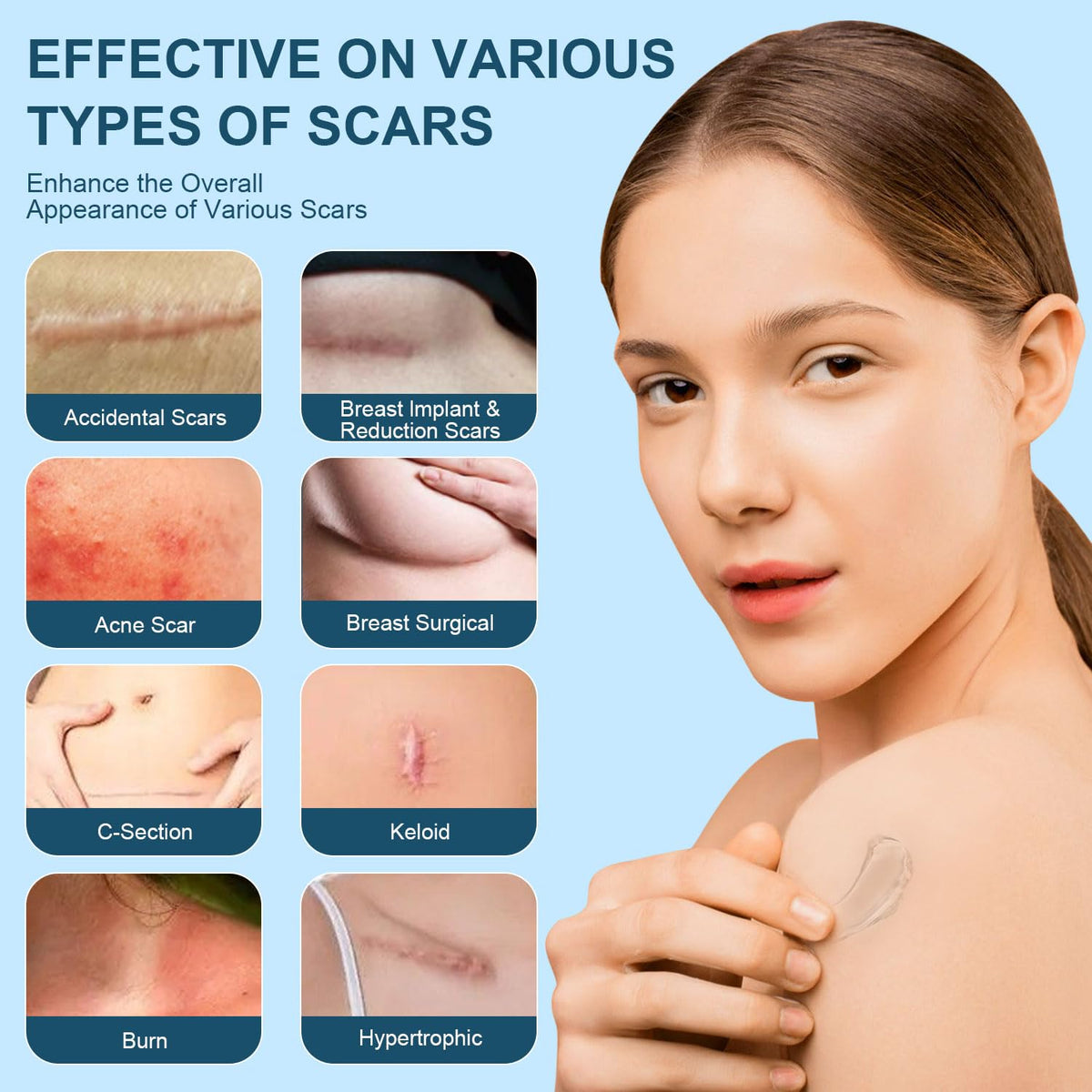 Mitgary Advanced Scar Gel, Silicone Scar Gel, Treats Old and New Scars, Reduces the Appearance of Scars from, Body, Face, Stretch Marks - FENGGESTORE20