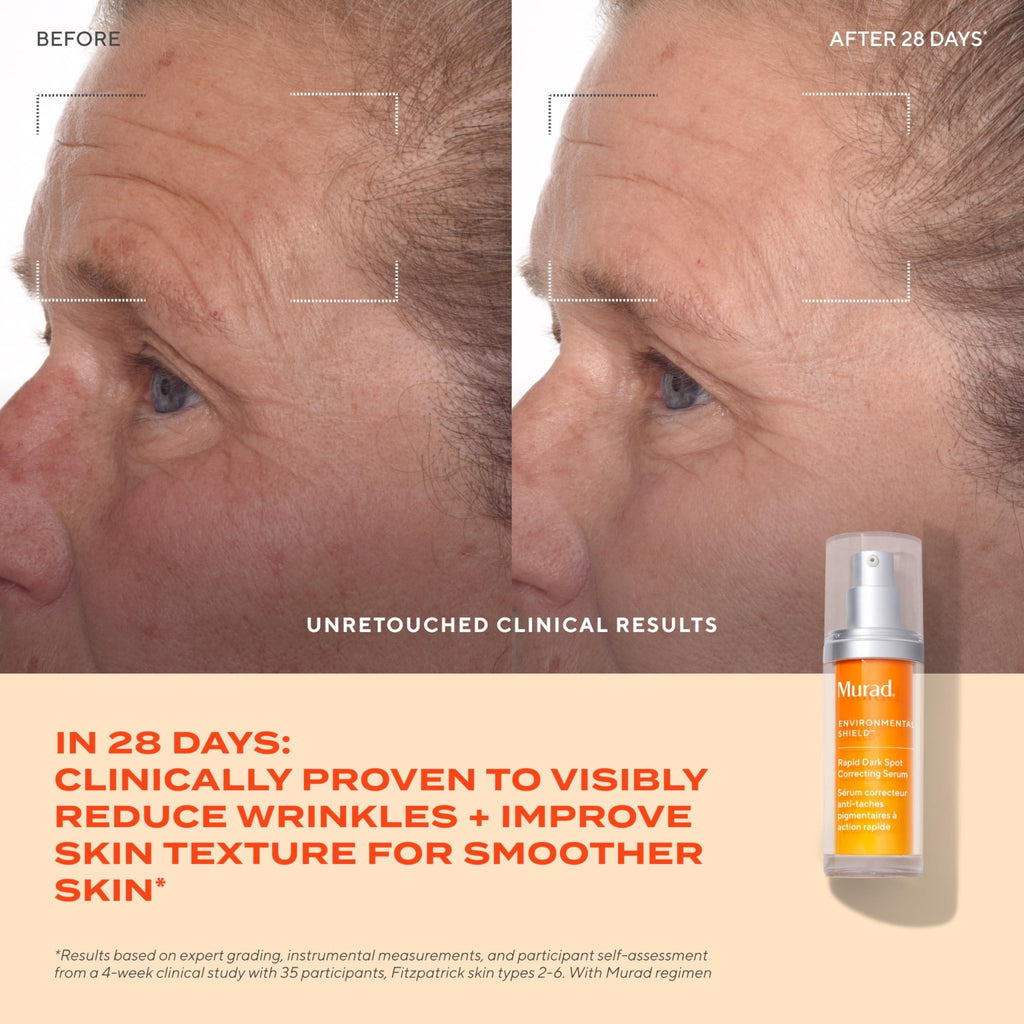 Murad Rapid Dark Spot Correcting Serum - Advanced Anti-Aging Formula with Patented Resorcinol Technology, Tranexamic and Glycolic Acids for Hyperpigmentation - FENGGESTORE20