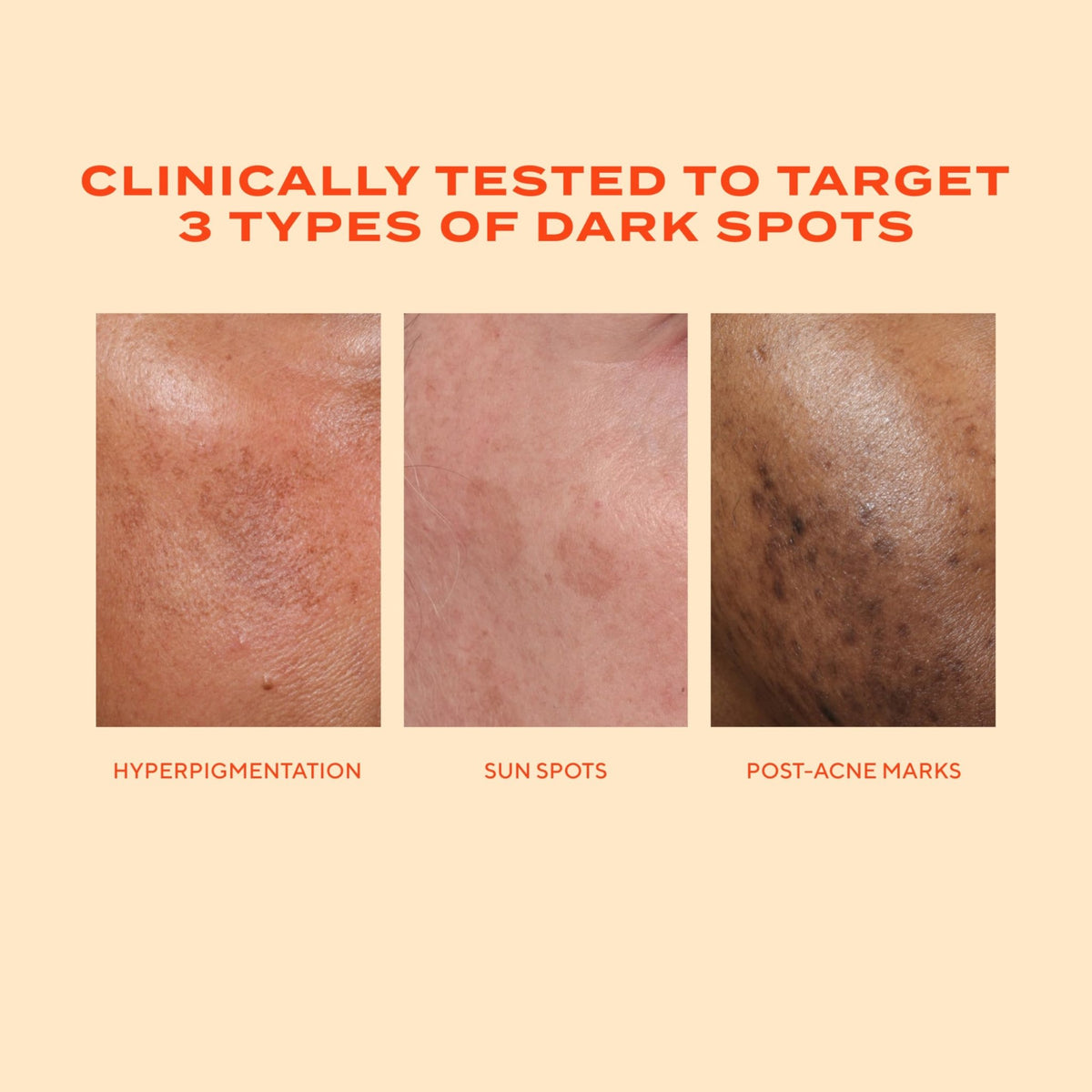 Murad Rapid Dark Spot Correcting Serum - Advanced Anti-Aging Formula with Patented Resorcinol Technology, Tranexamic and Glycolic Acids for Hyperpigmentation - FENGGESTORE20