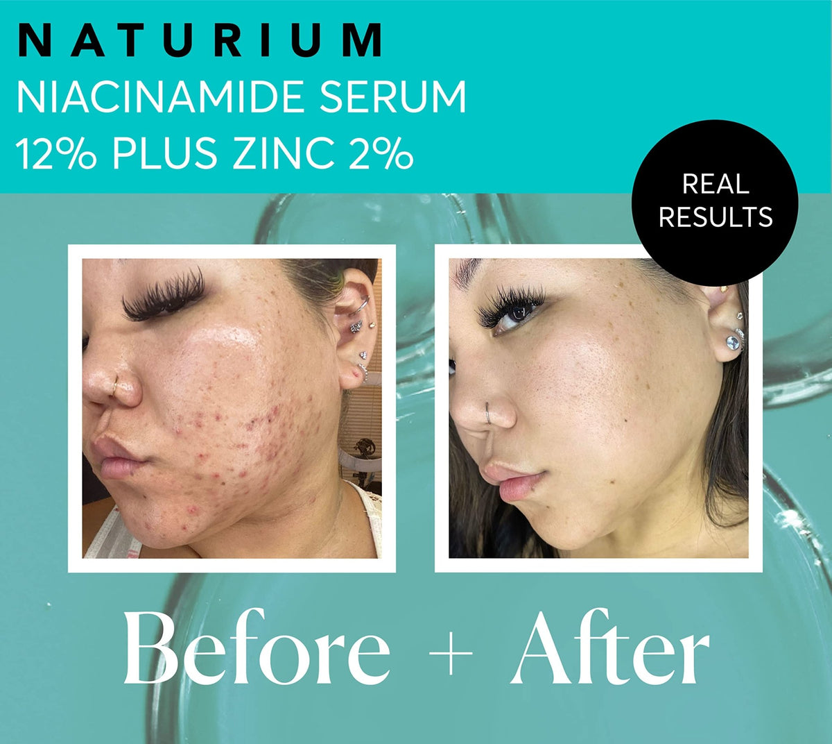 Naturium Niacinamide Face Serum 12% Plus Zinc 2%, Anti-Aging, Pore Minimizer & Dark Spot Corrector - FENGGESTORE20