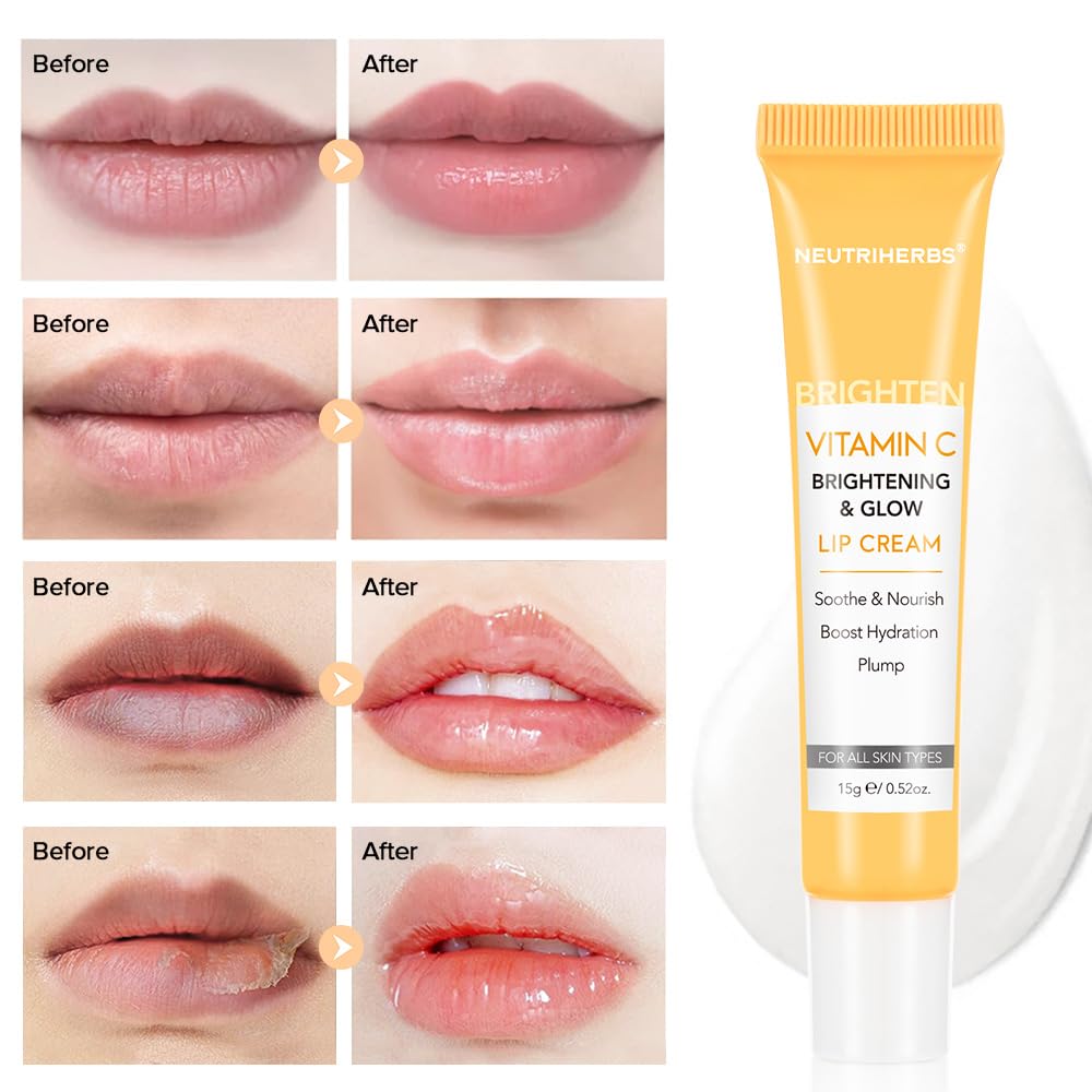 NEUTRIHERBS Lip Cream, Vitamin C Lip Balm to Nourish and Soothes Dry, Cracked Lips - FENGGESTORE20