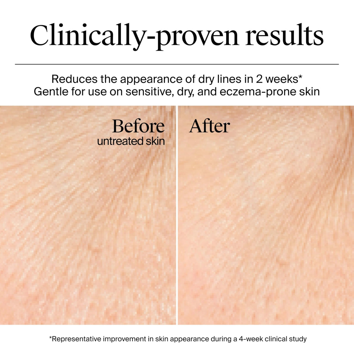 Neutrogena Hydro Boost Gel Cream, 48 Hr Hydration for Normal/Dry Skin, Fragrance Free - FENGGESTORE20