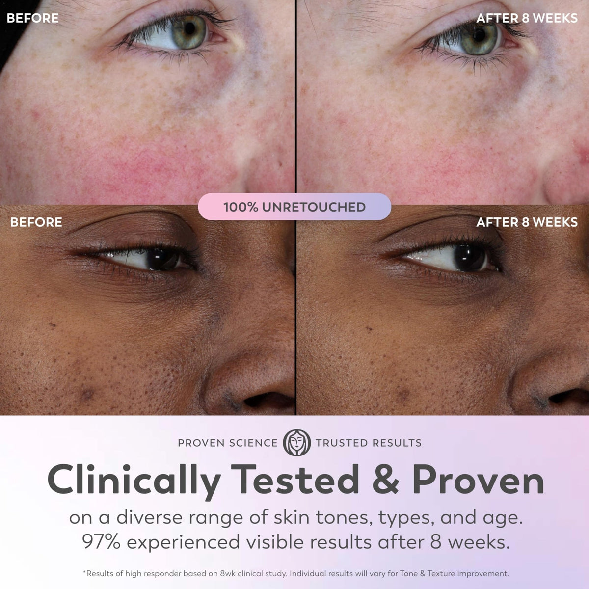 Olay Super Serum - Glow Serum for Face - Activated Niacinamide, Vitamin C & E, Collagen Peptide, AHA - 5-in-1 Benefits - Brightens, Hydrates, Smooths, Firms, Evens Tone, Proactive Anti-Aging, 1.7 Oz - FENGGESTORE20