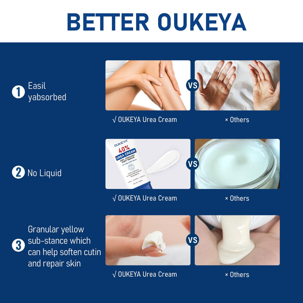 OUKEYA Urea Cream 40 Percent Tube 3 Oz, Foot & Hand Cream for Dry Cracked, 40 per Urea Lotion for Feet Maximum Strength - FENGGESTORE20