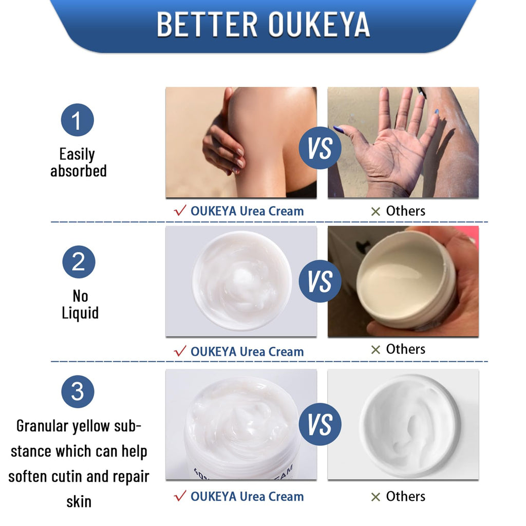 OUKEYA Urea Cream 40 Percent,Foot & Hand Cream for Dry Cracked,Urea Lotion for Feet Maximum Strength - FENGGESTORE20