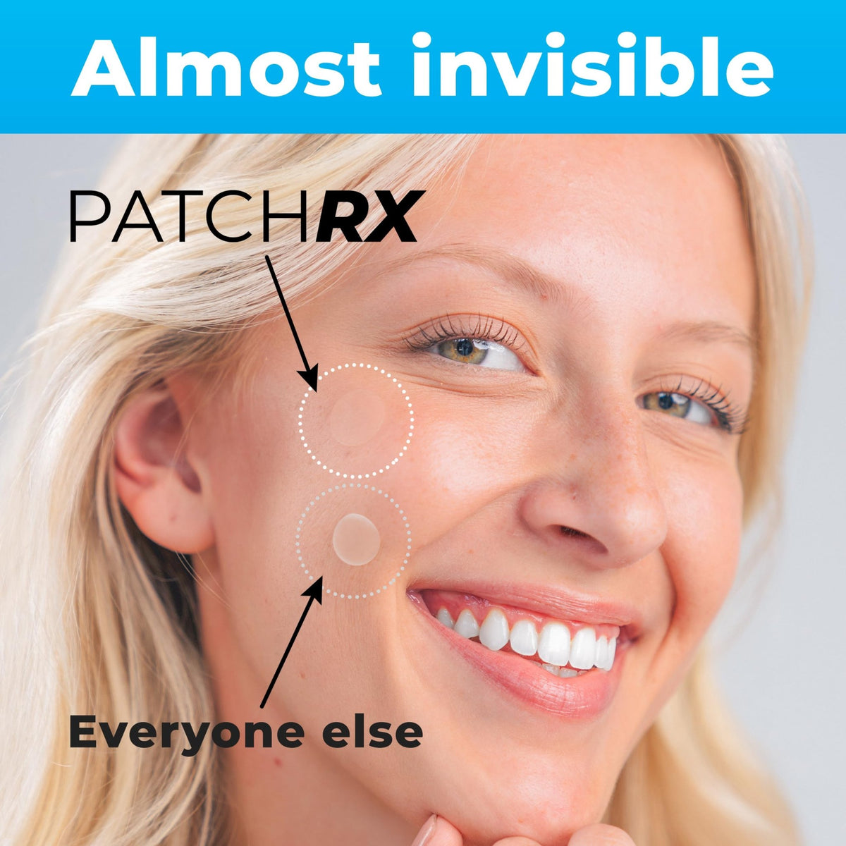 PatchRx Pimple Patches for Face (120 Patches), Hydrocolloid Acne Patches with Tea Tree Oil - FENGGESTORE20