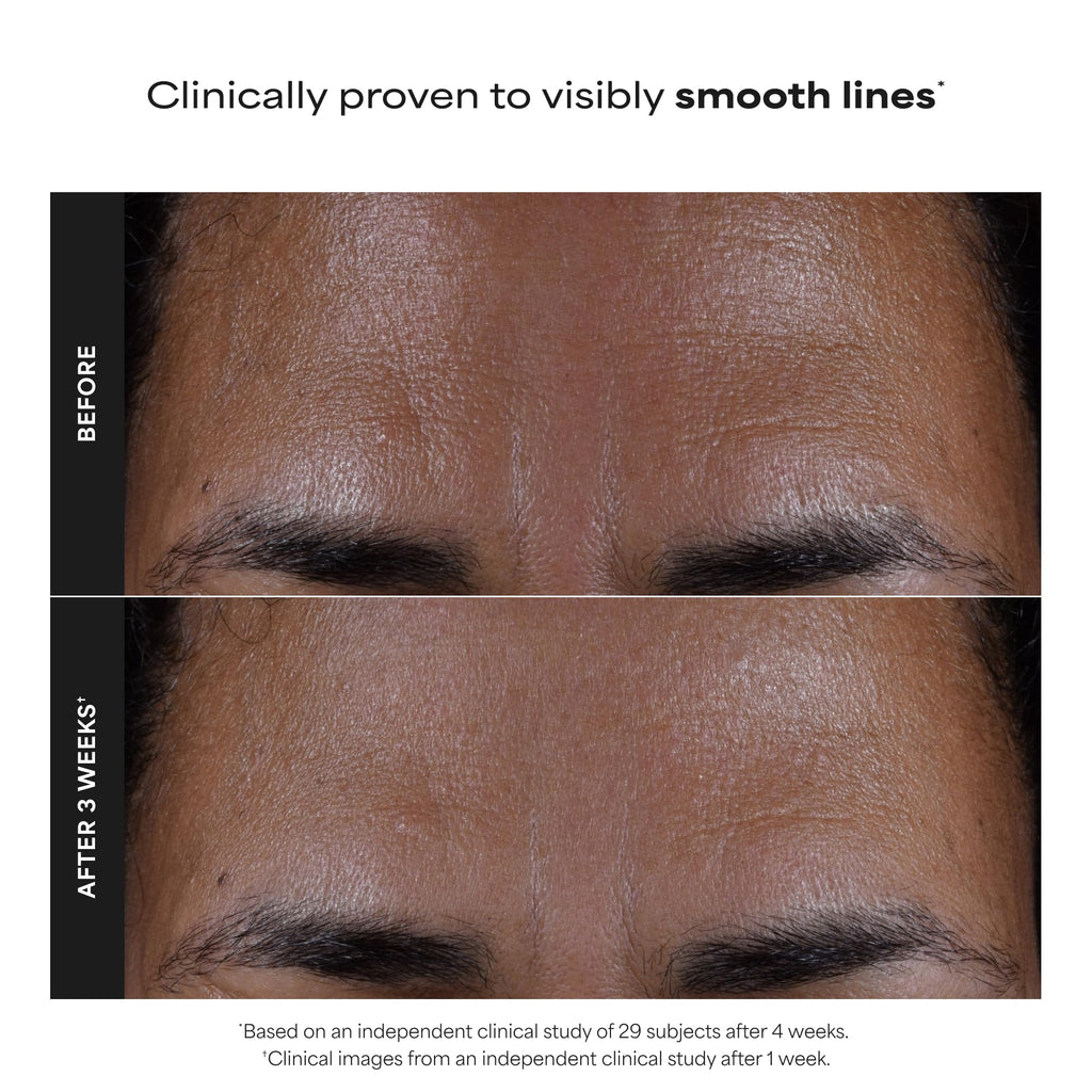 Paulas Choice - SKIN PERFECTING 2% BHA Liquid Salicylic Acid Exfoliant - Facial Exfoliant - FENGGESTORE20