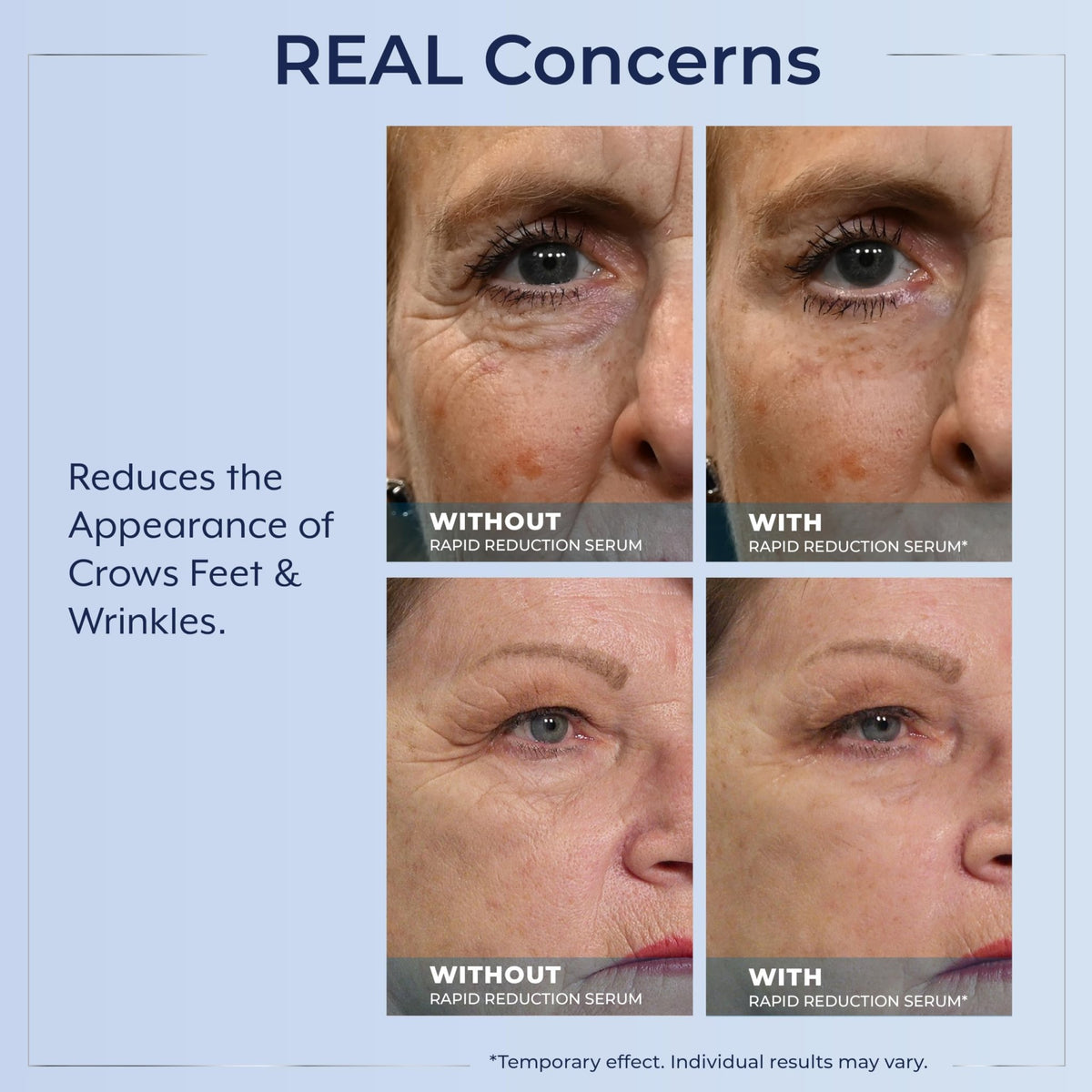 Plexaderm Rapid Reduction Eye Serum - Visibly Reduces Under-Eye Bags, Wrinkles, Dark Circles, Fine Lines & Crow's Feet Instantly - FENGGESTORE20
