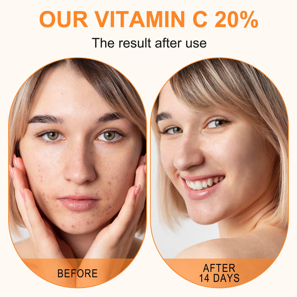 Premium 20% Vitamin C Serum For Face with Hyaluronic Acid, Retinol & Amino Acids - Boost Skin Collagen,Hydrate & Plump Skin, - FENGGESTORE20