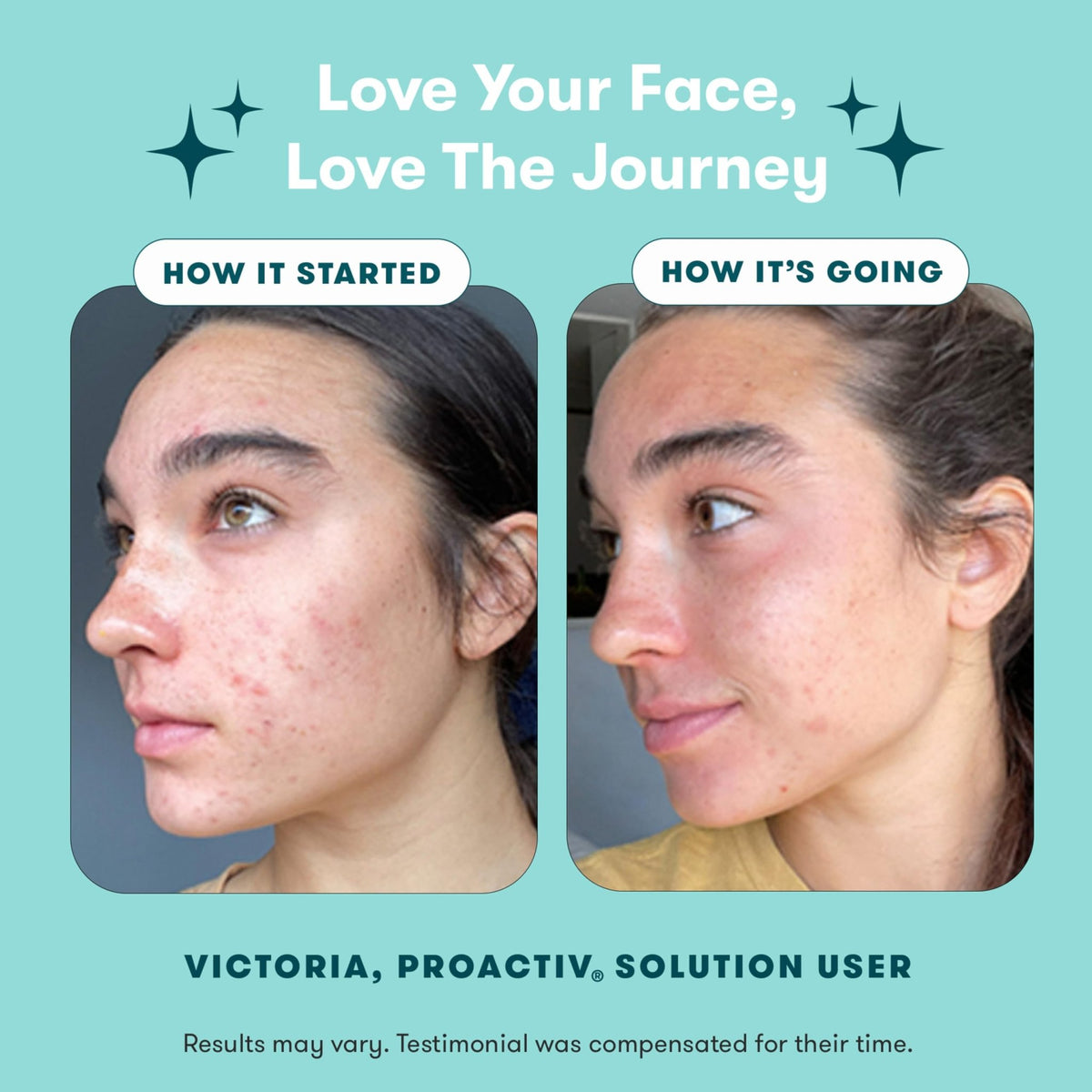 Proactiv 3 Step Acne Treatment - Benzoyl Peroxide Face Wash, Repairing Acne Spot Treatment for Face and Body - FENGGESTORE20