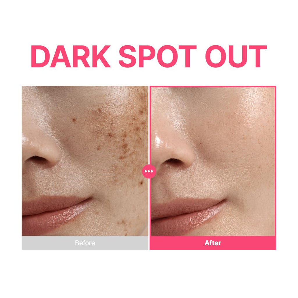 PURITO TXA 6% + Niacinamide 10% + Retinal Facial Serum | for Dark Spots, Hyperpigmentation, Uneven Tone - FENGGESTORE20