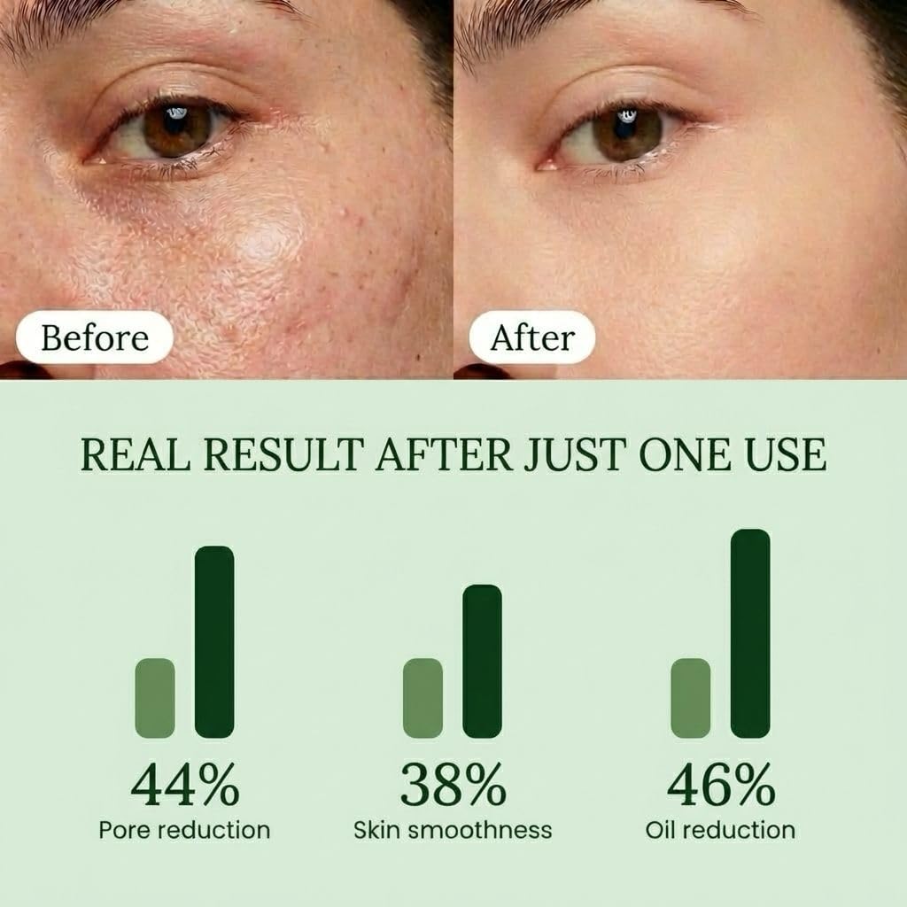 QUIA Toner Pads – AHA/BHA Dual-Action Exfoliate and Hydrate All in One – Soothing Formula for Sensitive Skin – Reduces Blackheads and Blemishes - FENGGESTORE20