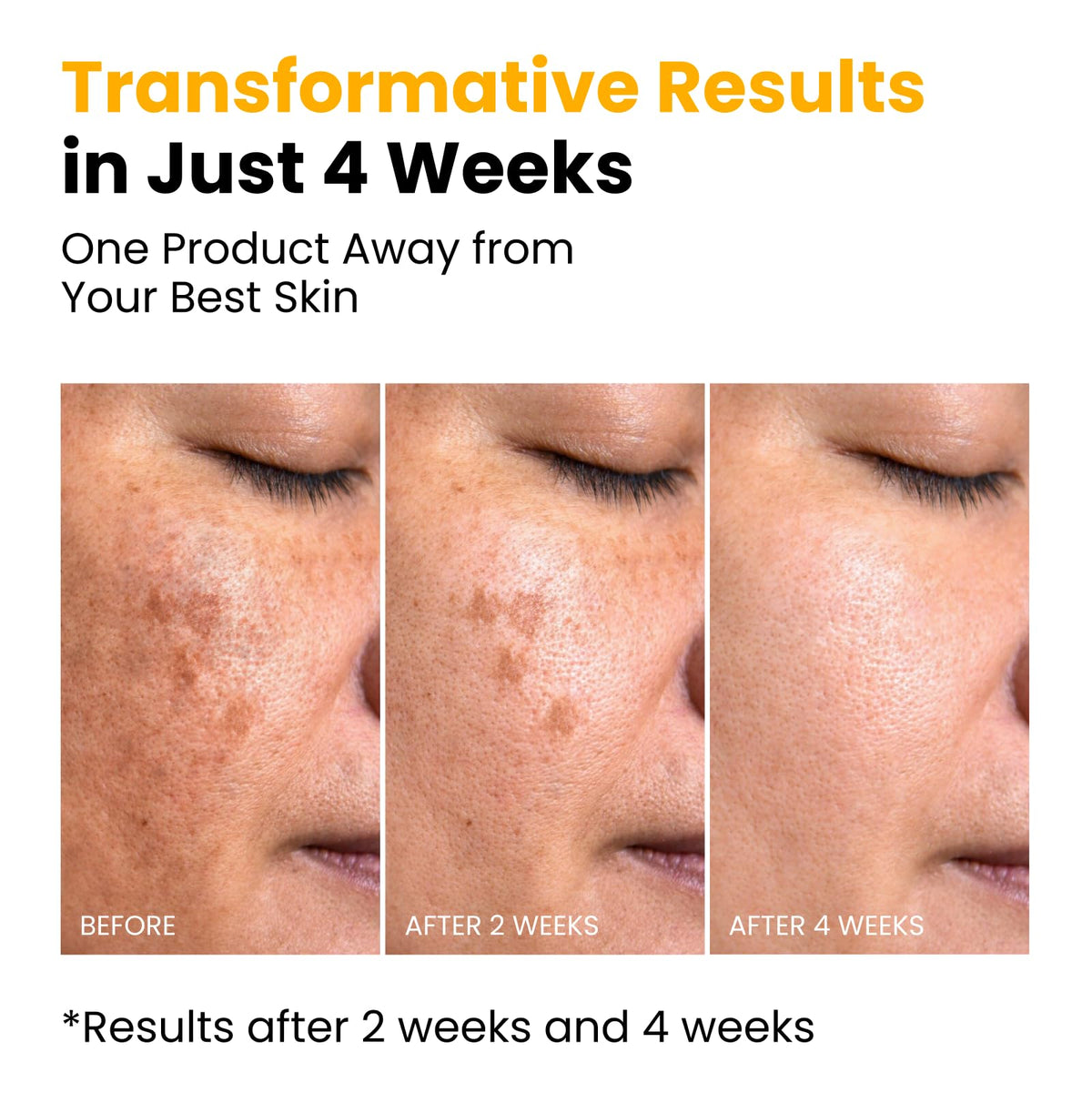 QUIA Turmeric + Kojic Acid Overnight Wrapping Mask – Hydration Mask for Glowing Skin - FENGGESTORE20
