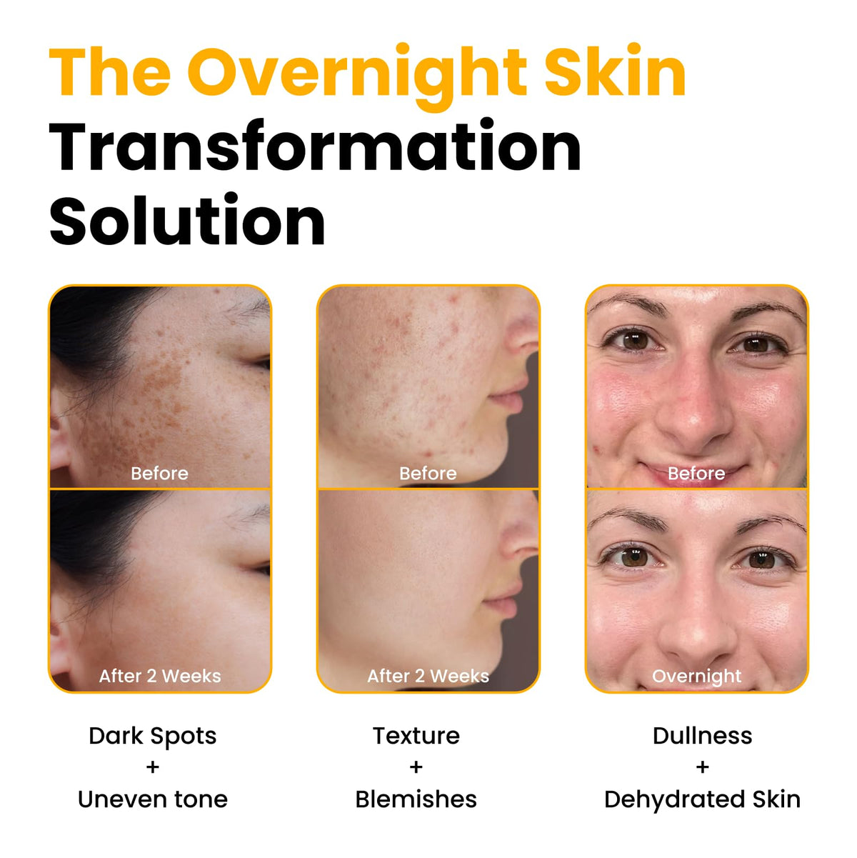 QUIA Turmeric + Kojic Acid Overnight Wrapping Mask – Hydration Mask for Glowing Skin - FENGGESTORE20