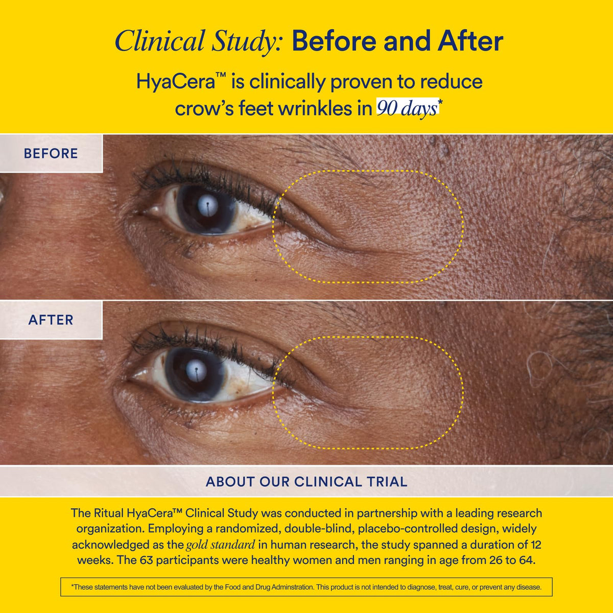 Ritual Hyaluronic Acid Skin Supplement - With Hyabest® and Ceratiq® - HyaCera Clinically Proven to Reduce Wrinkles, Fine Lines & Improve Skin Smoothness - FENGGESTORE20