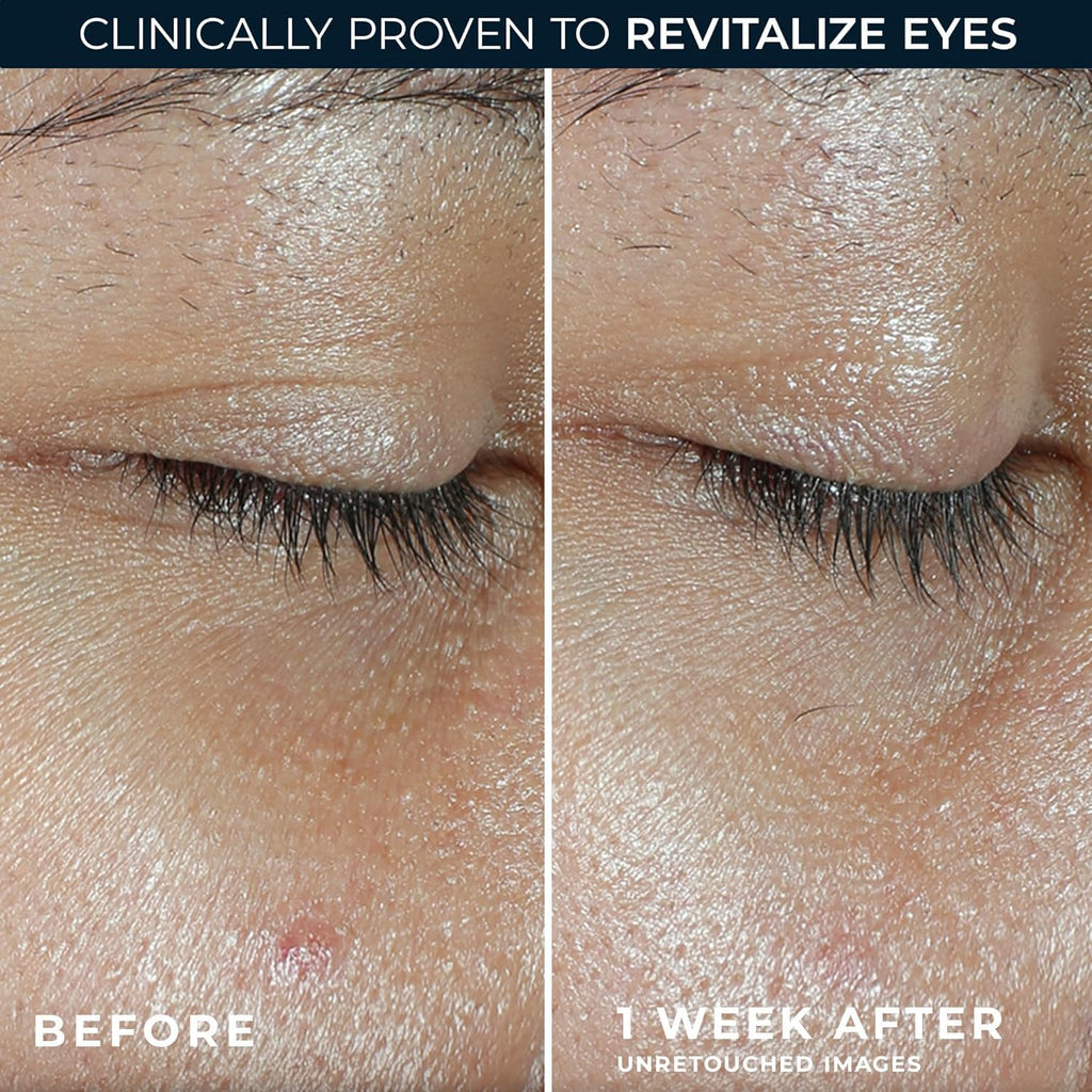 RoC Multi Correxion Revive + Glow Eye Balm with Vitamin C (0.14 oz) + Retinol Eye Cream Packette - FENGGESTORE20