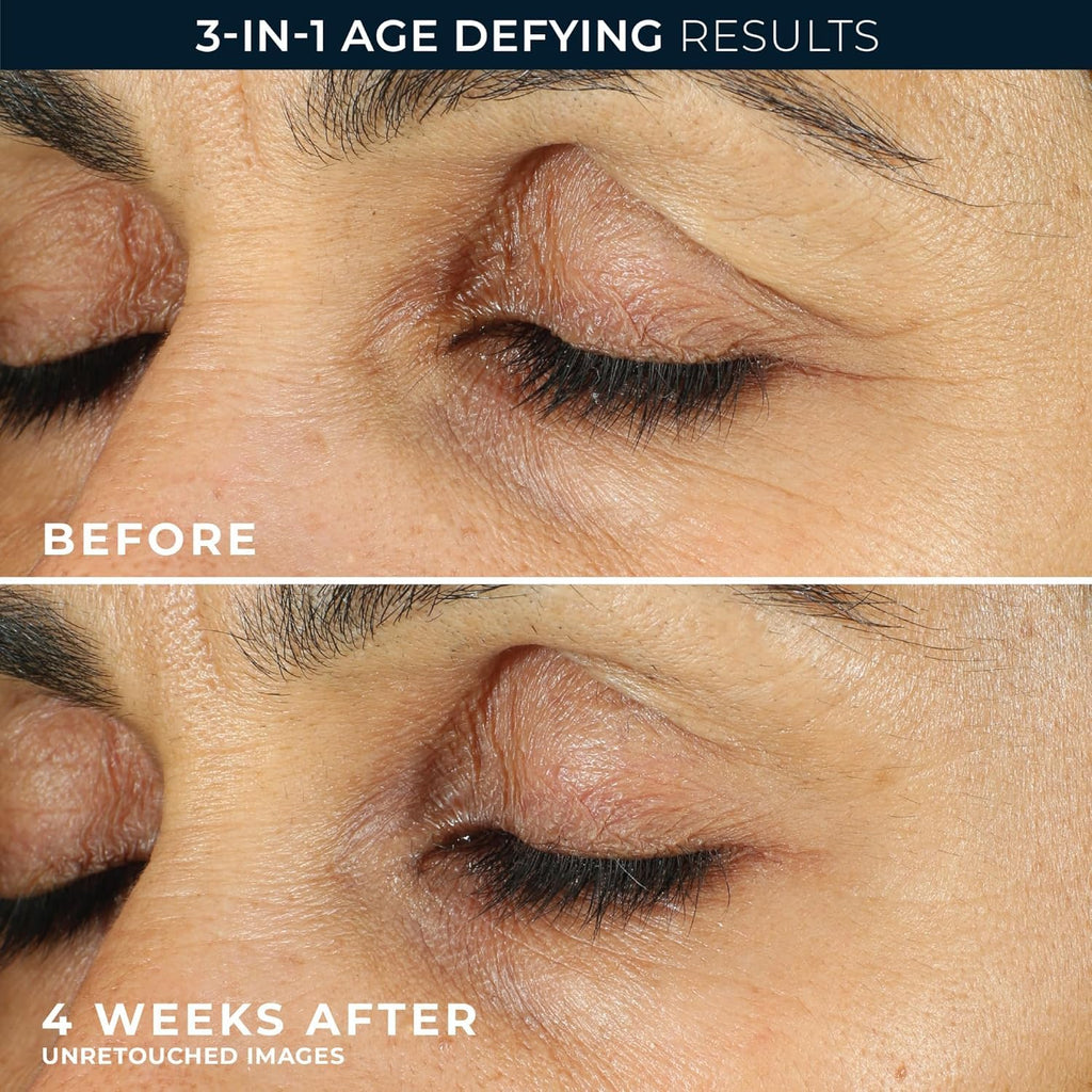 RoC Retinol Correxion Under Eye Cream for Dark Circles & Puffiness, Daily Wrinkle Cream - FENGGESTORE20