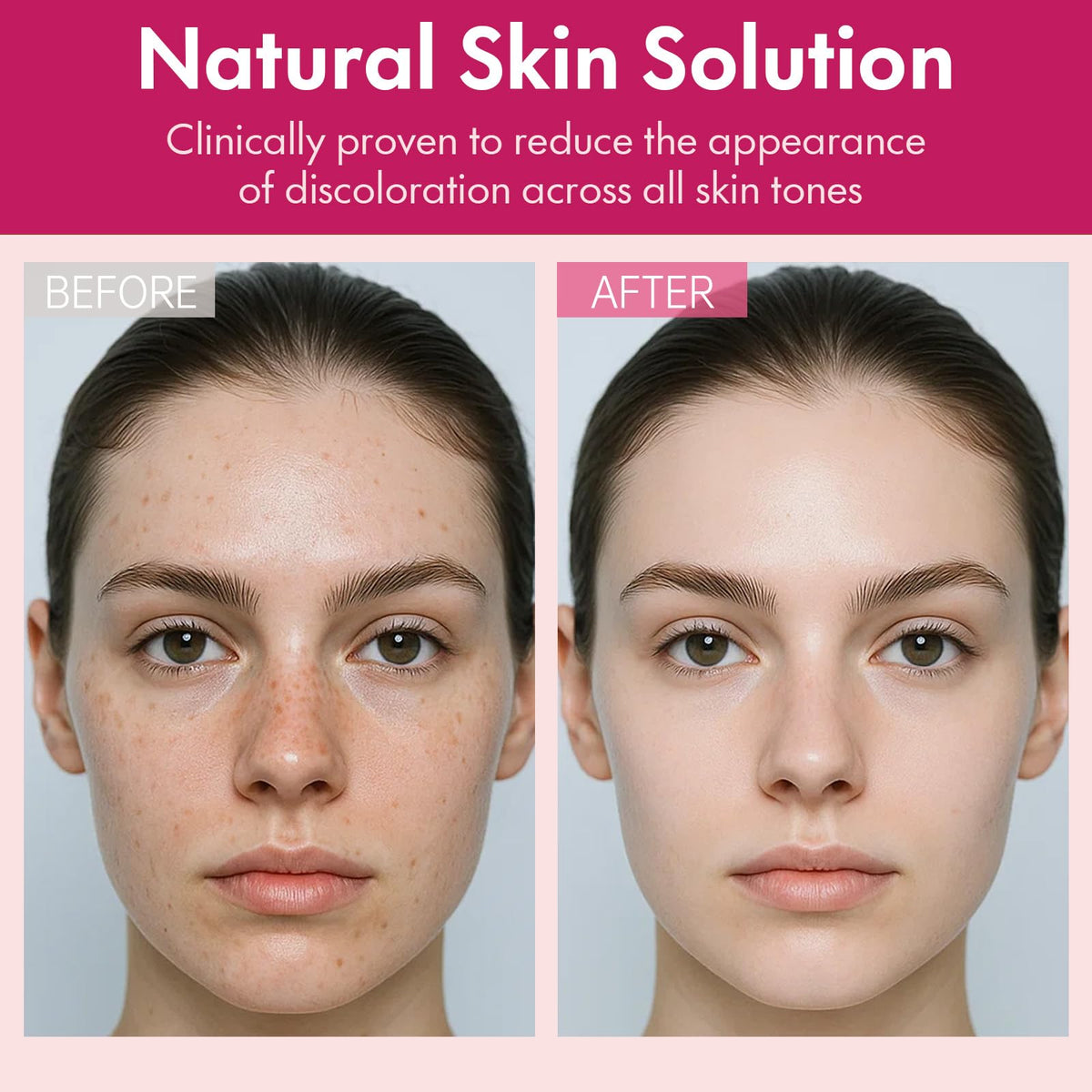Roseblem Arbutin 7% + Tranexamic Acid 4% Face Cream for Dark Spots & Uneven Skin Tone - FENGGESTORE20