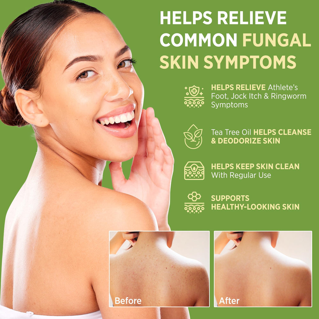 Roycederm Antifungal Bar Soap - Tea tree Oil Soap - Athlete’s Foot Treatment for Jock Itch & Ringworm - FENGGESTORE20
