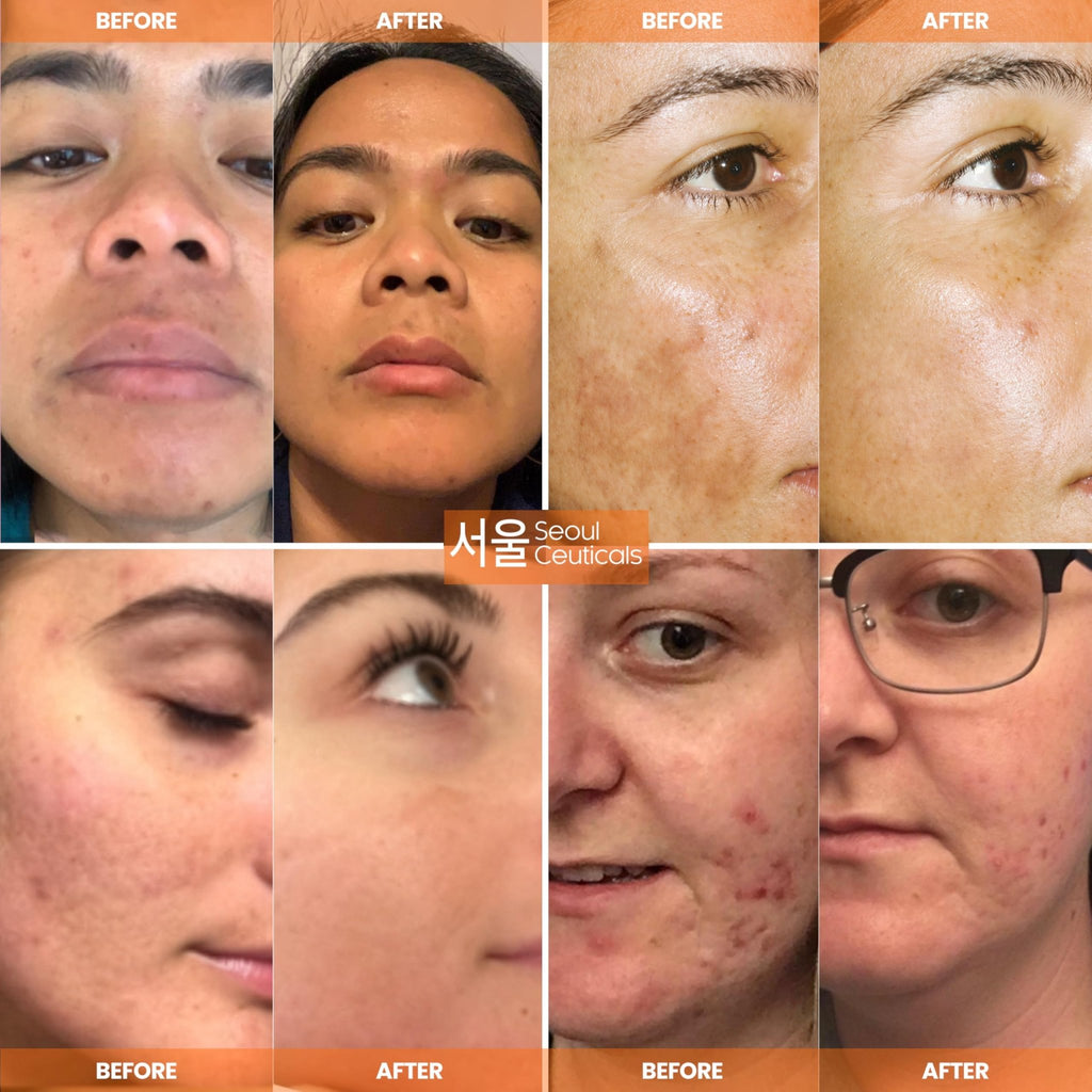 SeoulCeuticals Korean Skin Care 20% Vitamin C Hyaluronic Acid Serum + CE Ferulic Acid - FENGGESTORE20