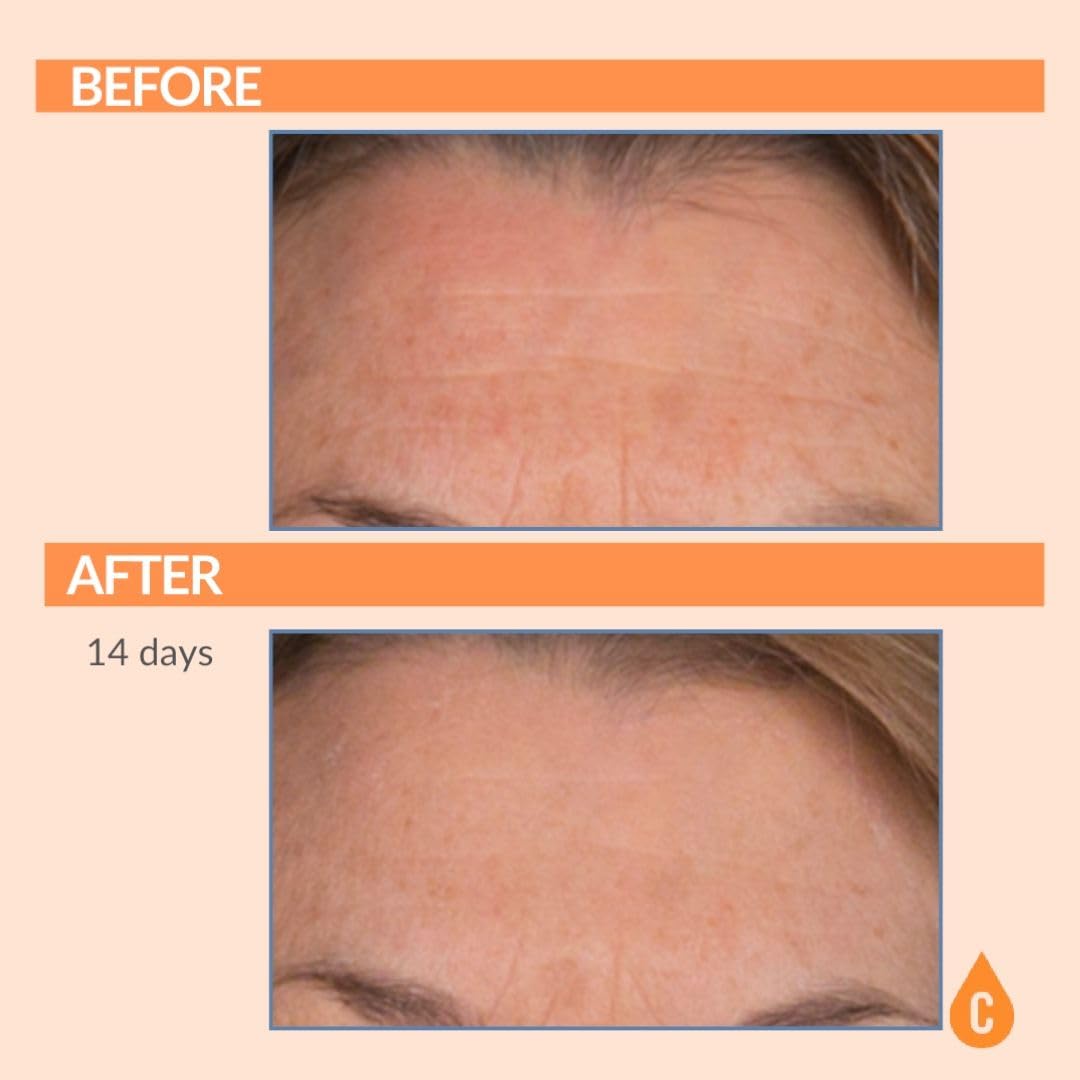 Serious Skincare Vitamin C Serum for Face, Anti-Aging Face Serum with Collagen, Vitamin E, Hydrating Skin Care for Brightening, Improve Appearance of Dark Spots - FENGGESTORE20