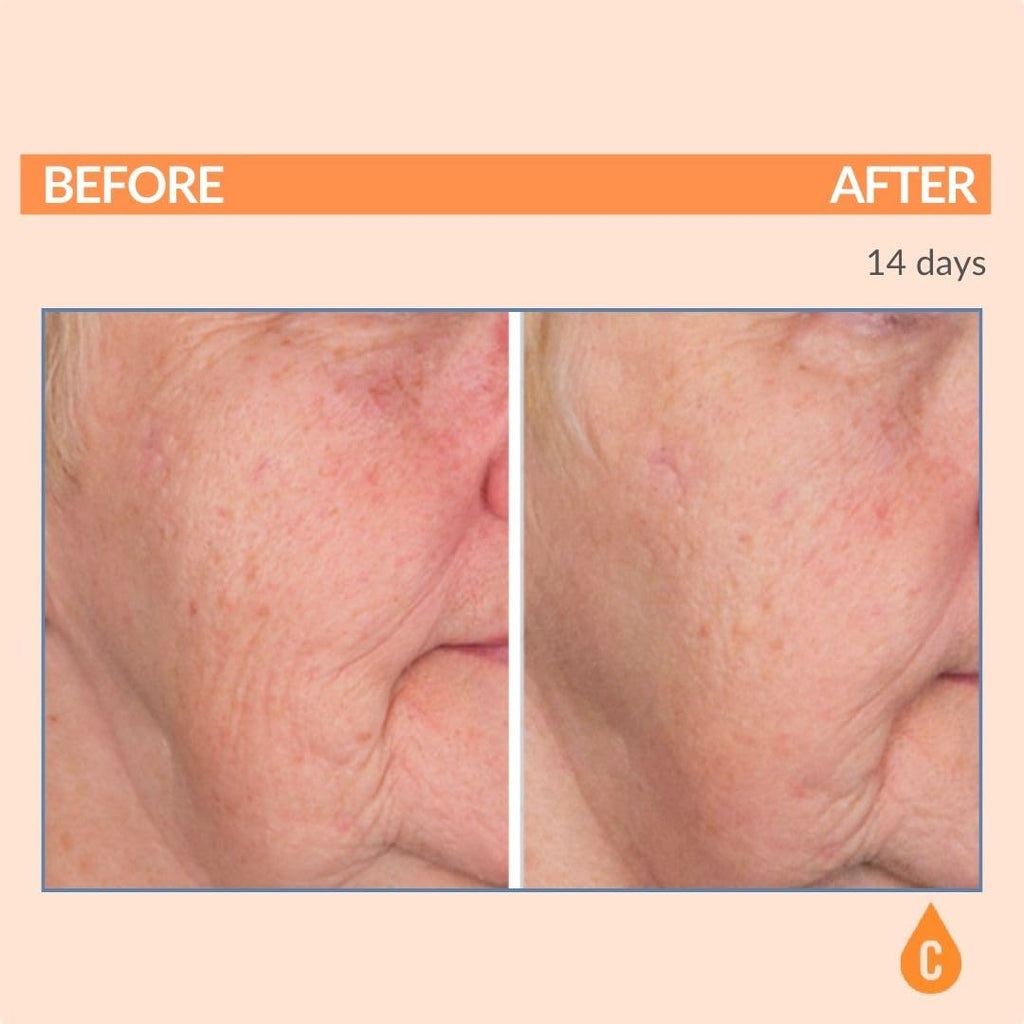 Serious Skincare Vitamin C Serum for Face, Anti-Aging Face Serum with Collagen, Vitamin E, Hydrating Skin Care for Brightening, Improve Appearance of Dark Spots - FENGGESTORE20